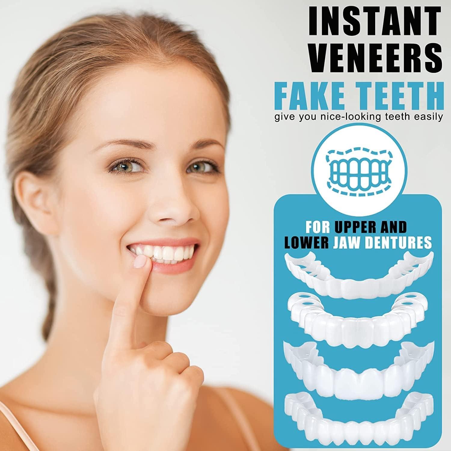 jhongla Dental veneers are top and Bottom dentures for Temporary Dental