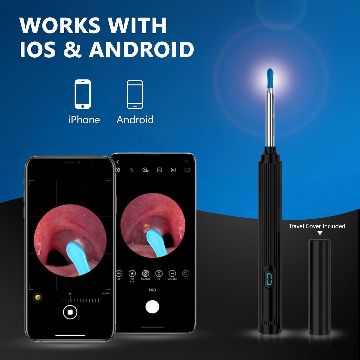 Buy Ear Wax Removal Tool - Wireless Ear Cleaner with Camera & Light for iOS & Android - Effective Earwax Removal Kit (Black | Buy Now with Express International Delivery | GoSupps.com