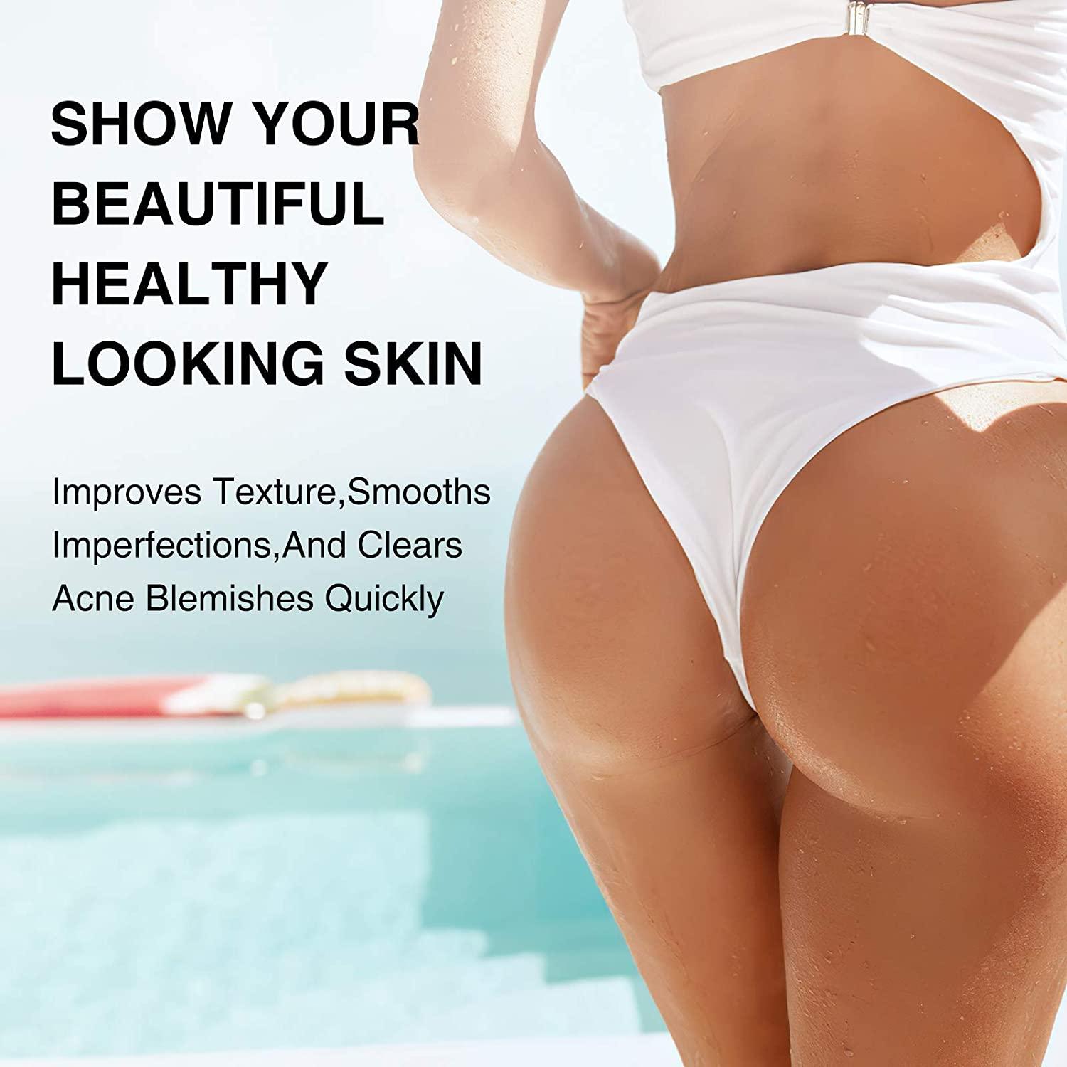 Boils: Pictures on Skin, Causes, and Treatment - WebMD