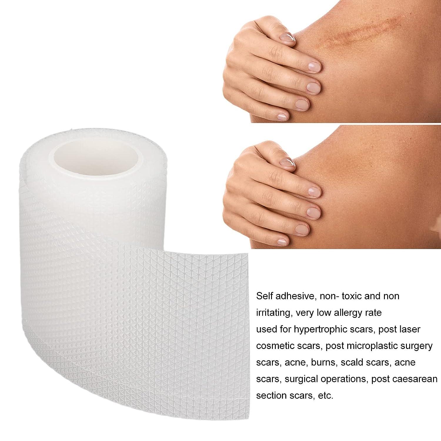 Silicone Scar Sheets Scar Removal Strips for Scar Concealing and