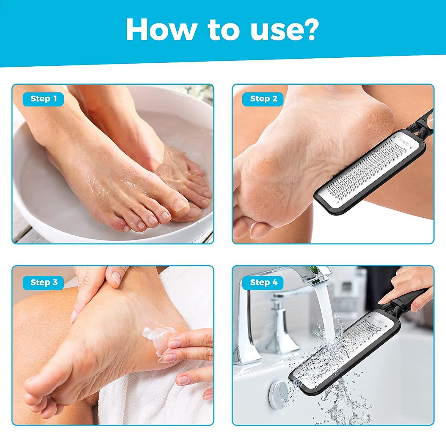 Minkissy 4pcs Stainless Steel Foot Rasp Foot File Callus Remover