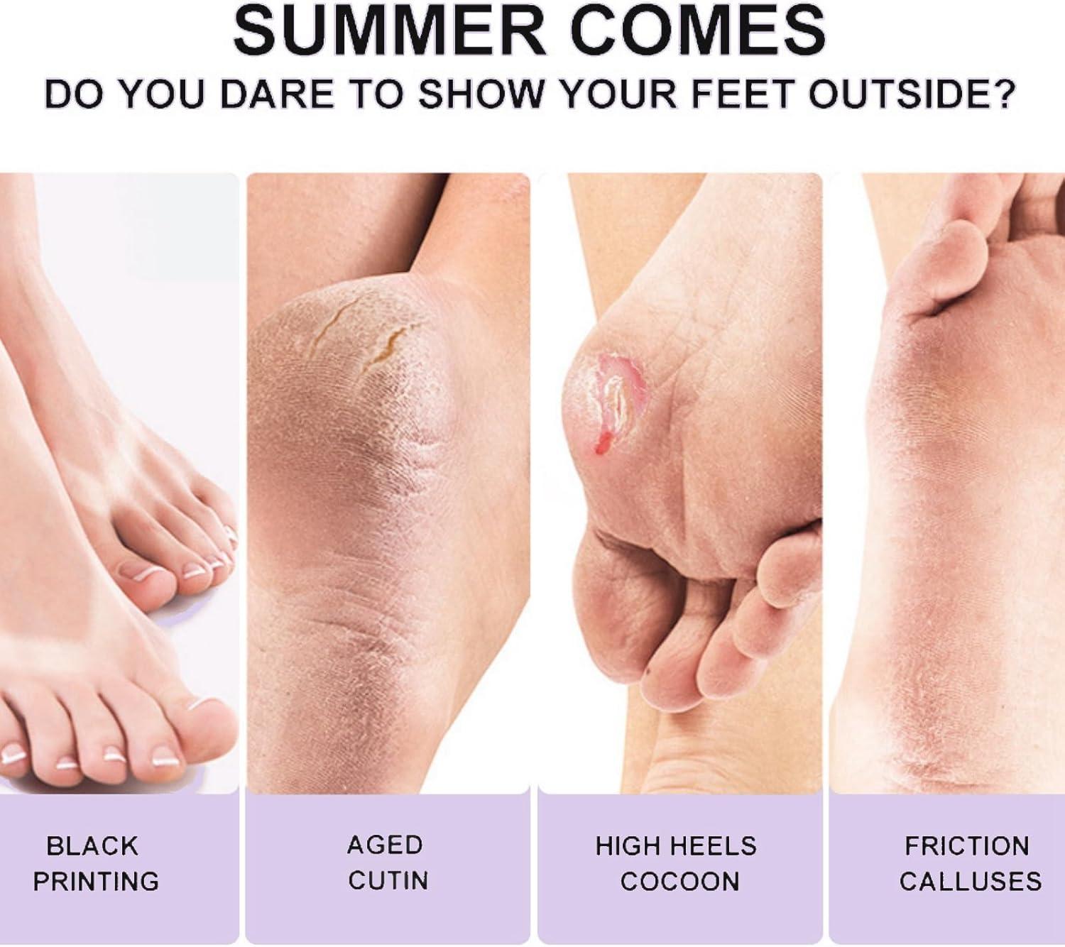 3Pairs Foot Peel Mask Foot Care Exfoliating Foot Peeling Mask for