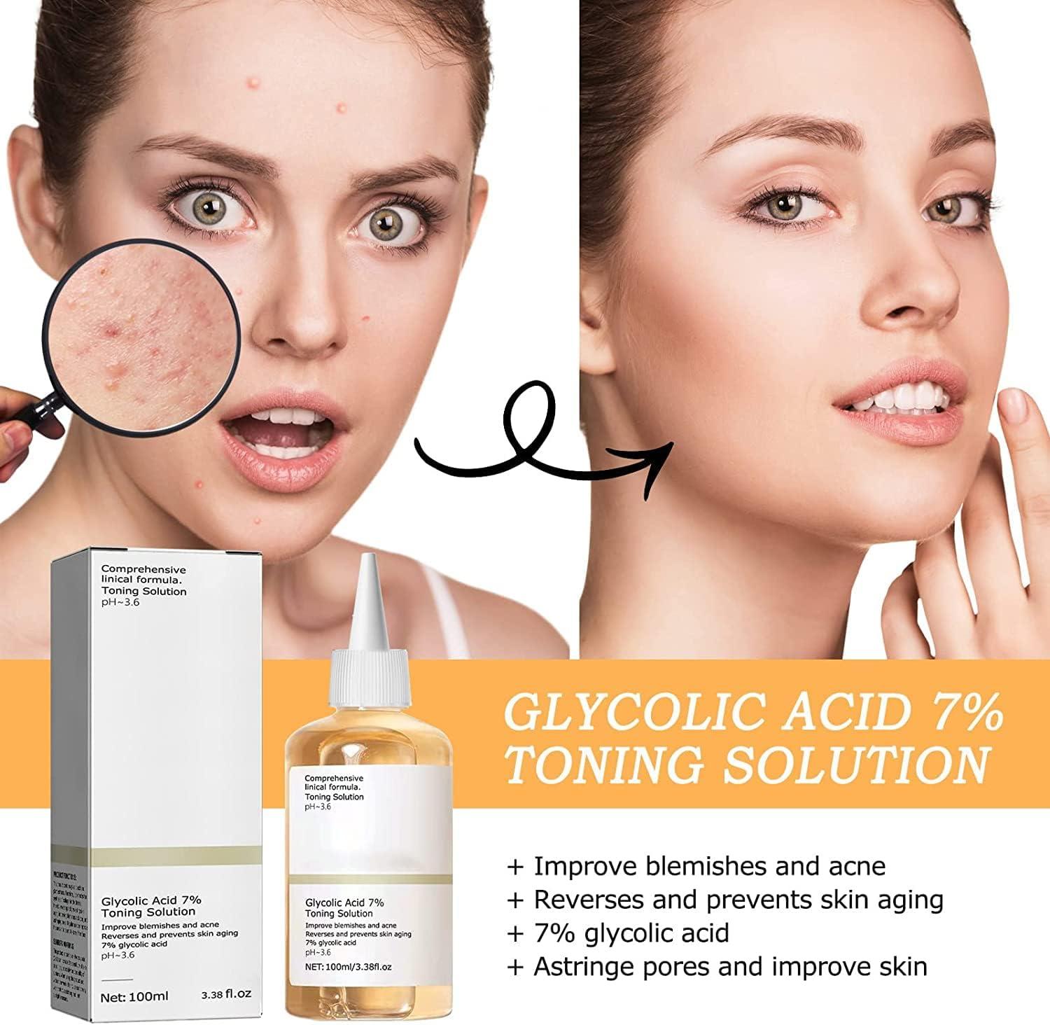 Glycolic Acid 7 Toning Resurfacing Solution Exfoliate Brighten and