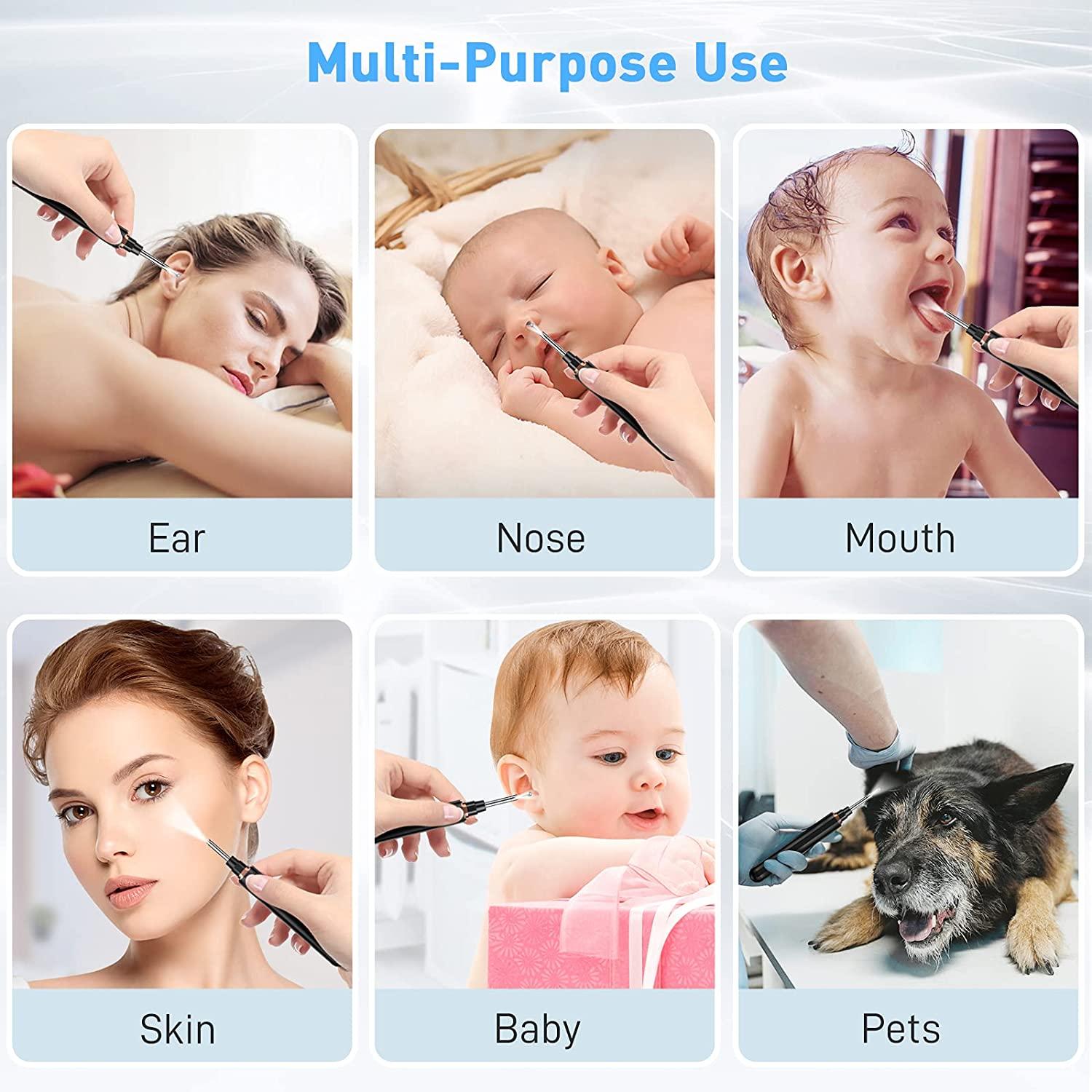 AWELOR Ear Wax Removal Camera 1296P HD Endoscope Ear Cleaner for