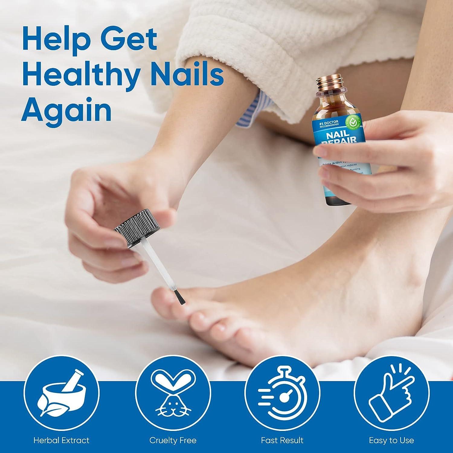 Nail Psoriasis: What It Is, Causes, Nail Pitting, Treatment