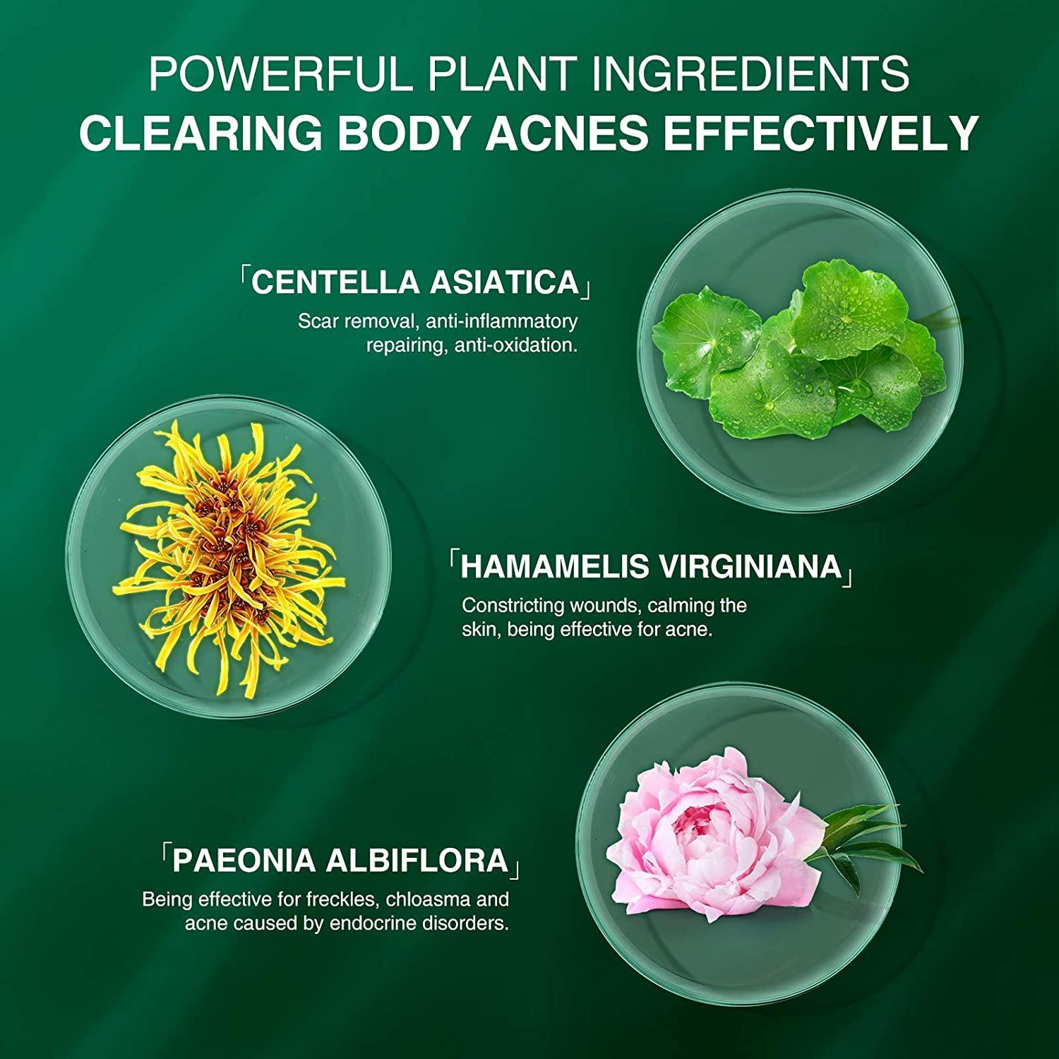 Butt & Thigh Anti Acne Cream,Body Acne Cream,Removing Acne,Pimples and Ingrown Hairs for