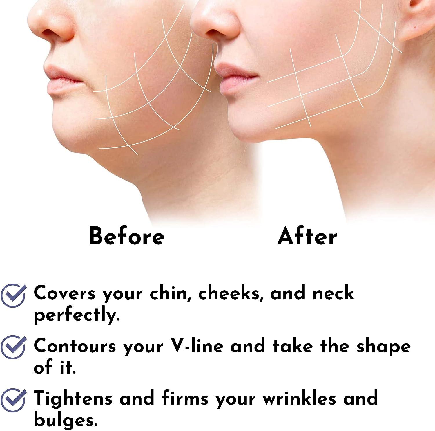 Post Surgery Facial Compression Neck Coverage Chin Strap, VShaped Face Slimmer, Jowl Tightening