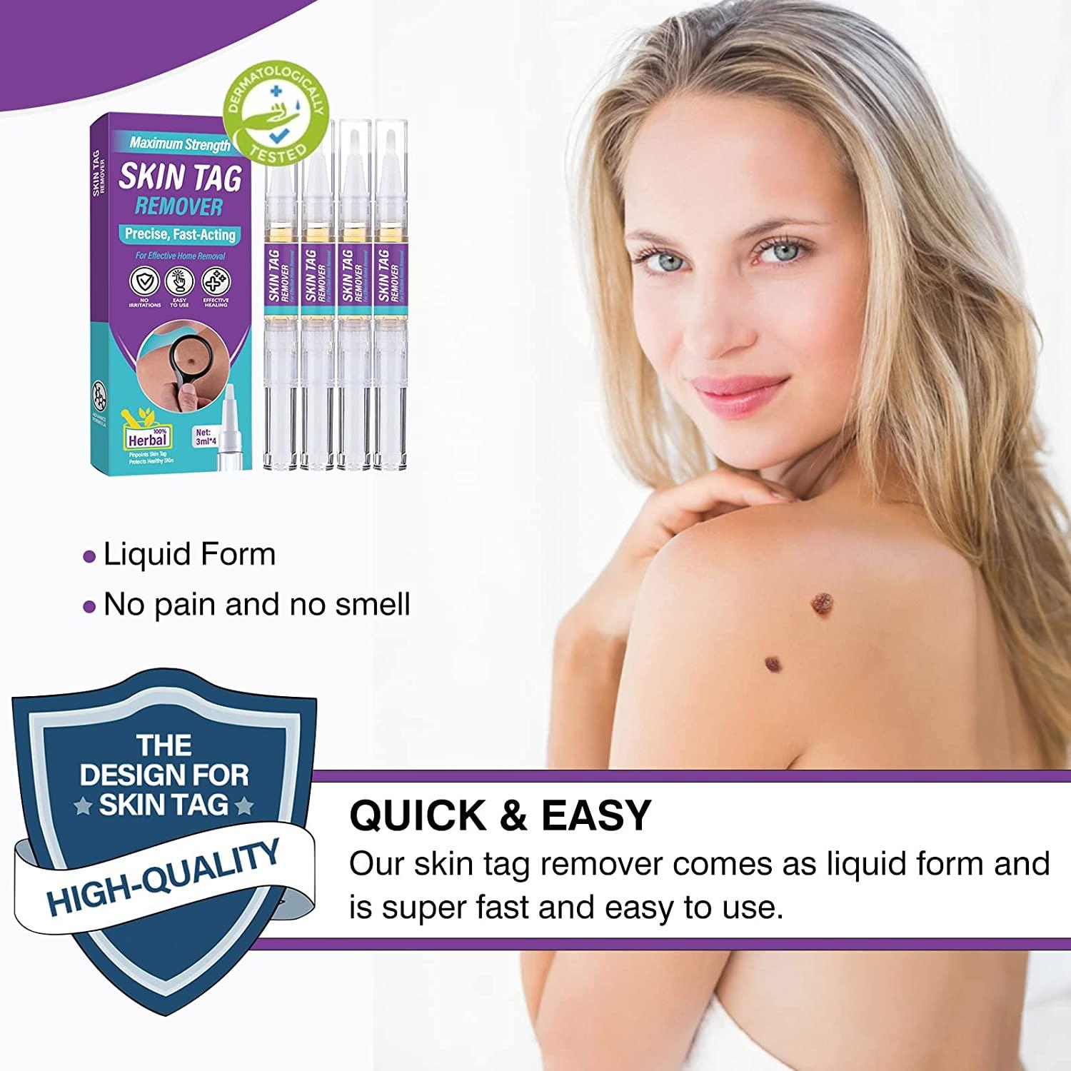 Skin Tag Remover, Extra Strength Wart Remover FastActing & Easy to Apply, Tag Dry and Fall