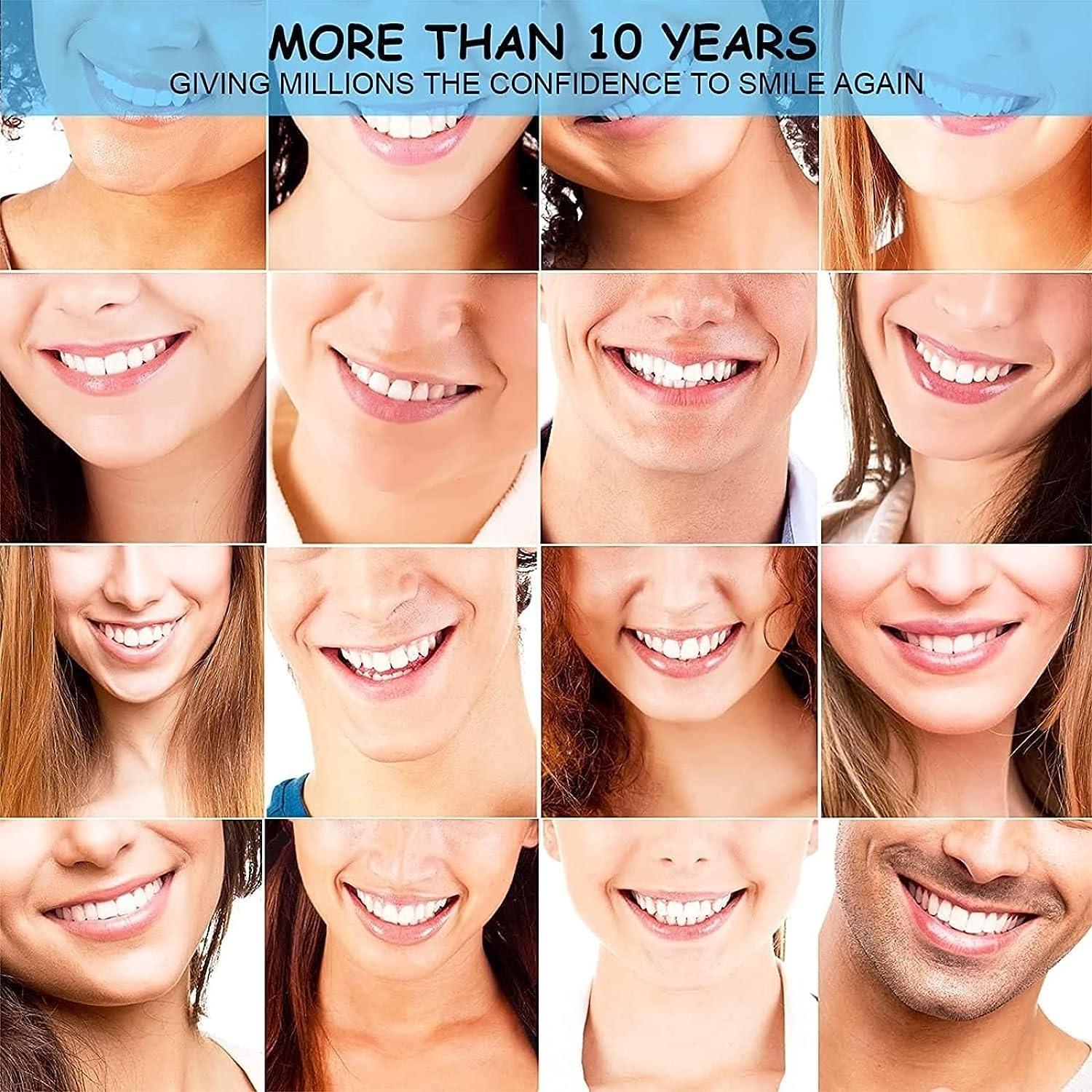 CAILING 1 Set Teeth Molding Kit, Denture Repair Kit for Snap Covering