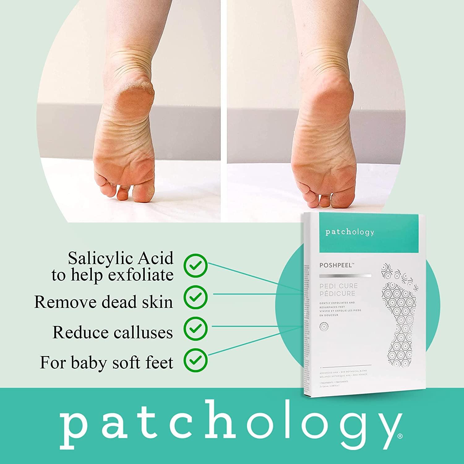 Patchology PoshPeel Pedi Cure Intensive Foot Peel Mask Treatment and