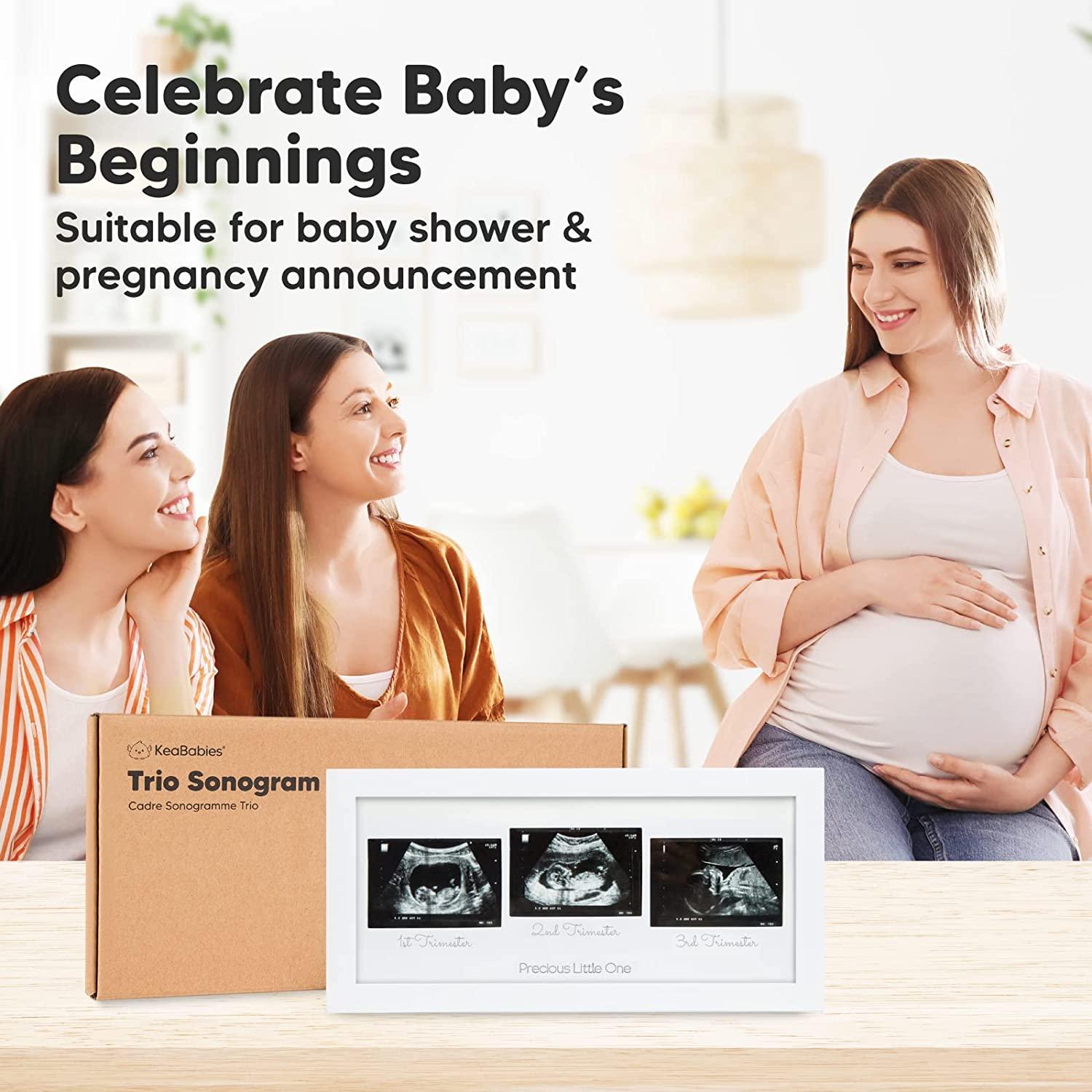 Sonogram Picture Frame Trio Ultrasound Frames for Mom to Be Baby