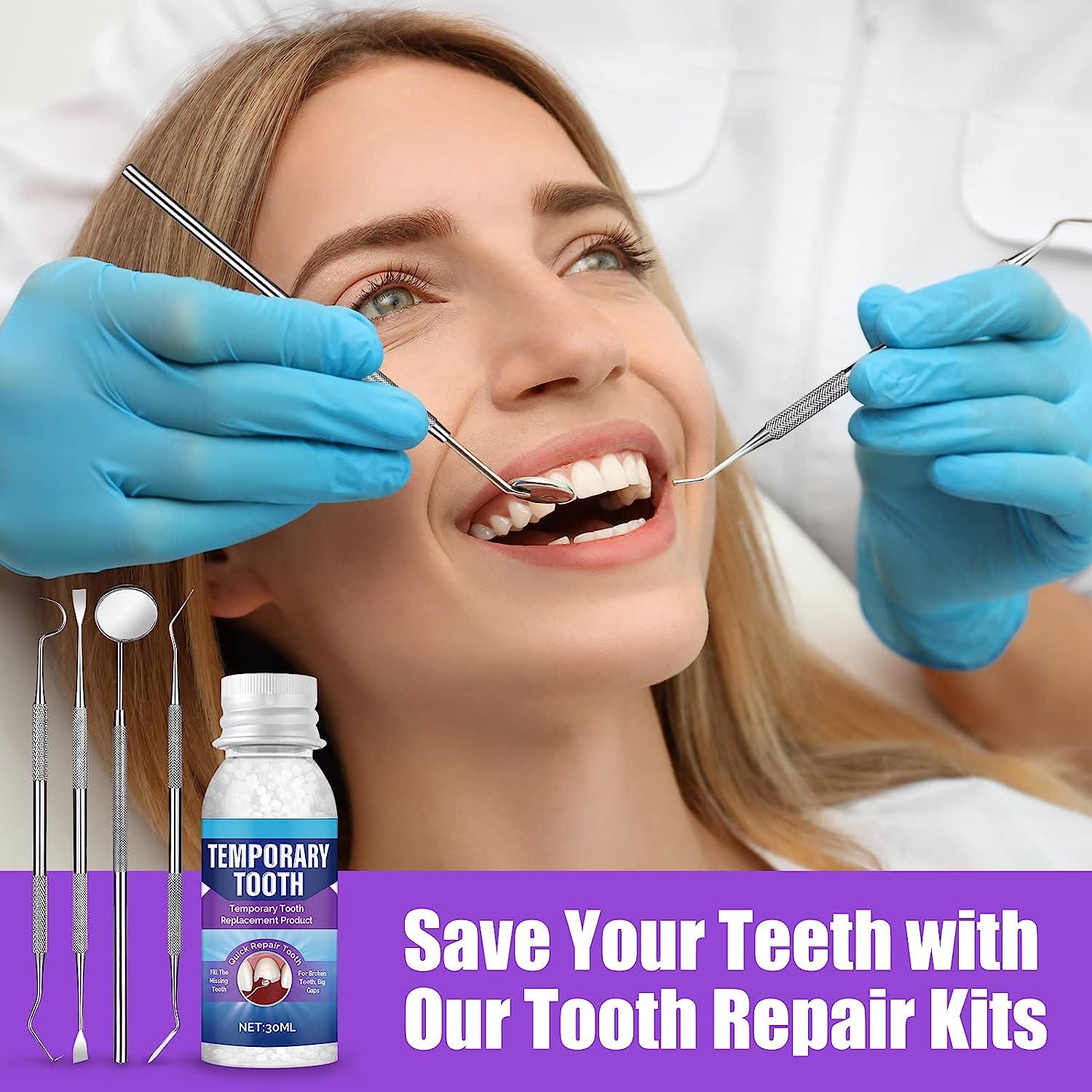 QQCherry Tooth Repair Kit, Temporary Teeth Replacement Fixing The