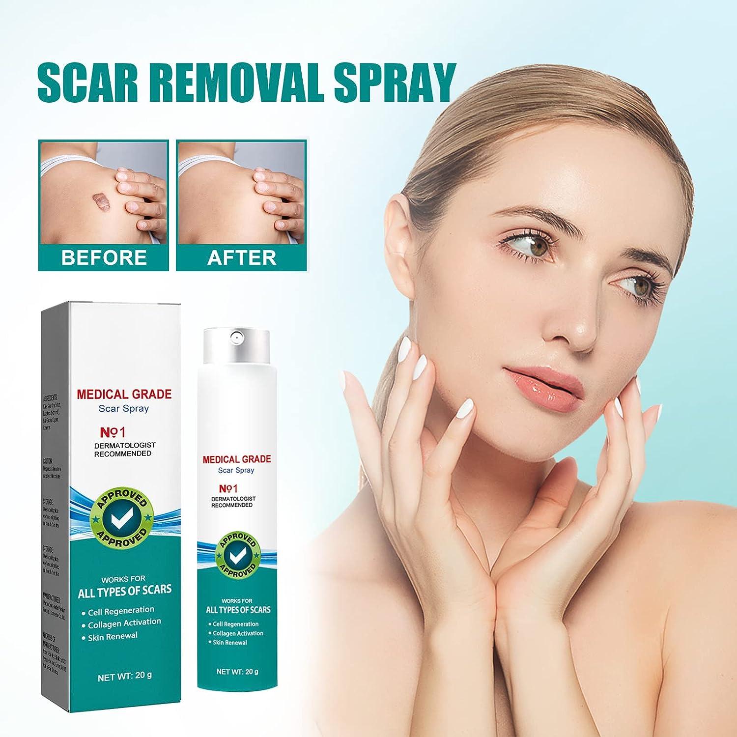3Pcs Medical Grade Scar Remove Spray Advanced Acne Scar Treatment