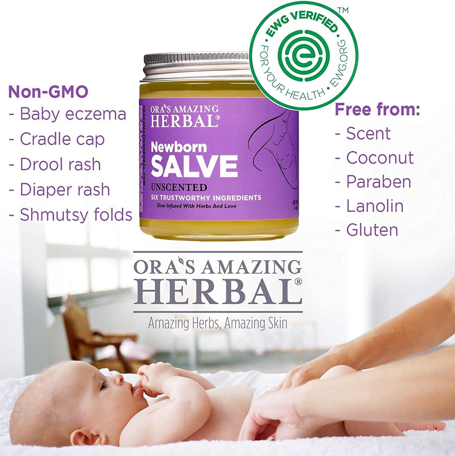 Organic Calendula Newborn Salve | Baby Acne & Eczema Treatment | Cradle ...