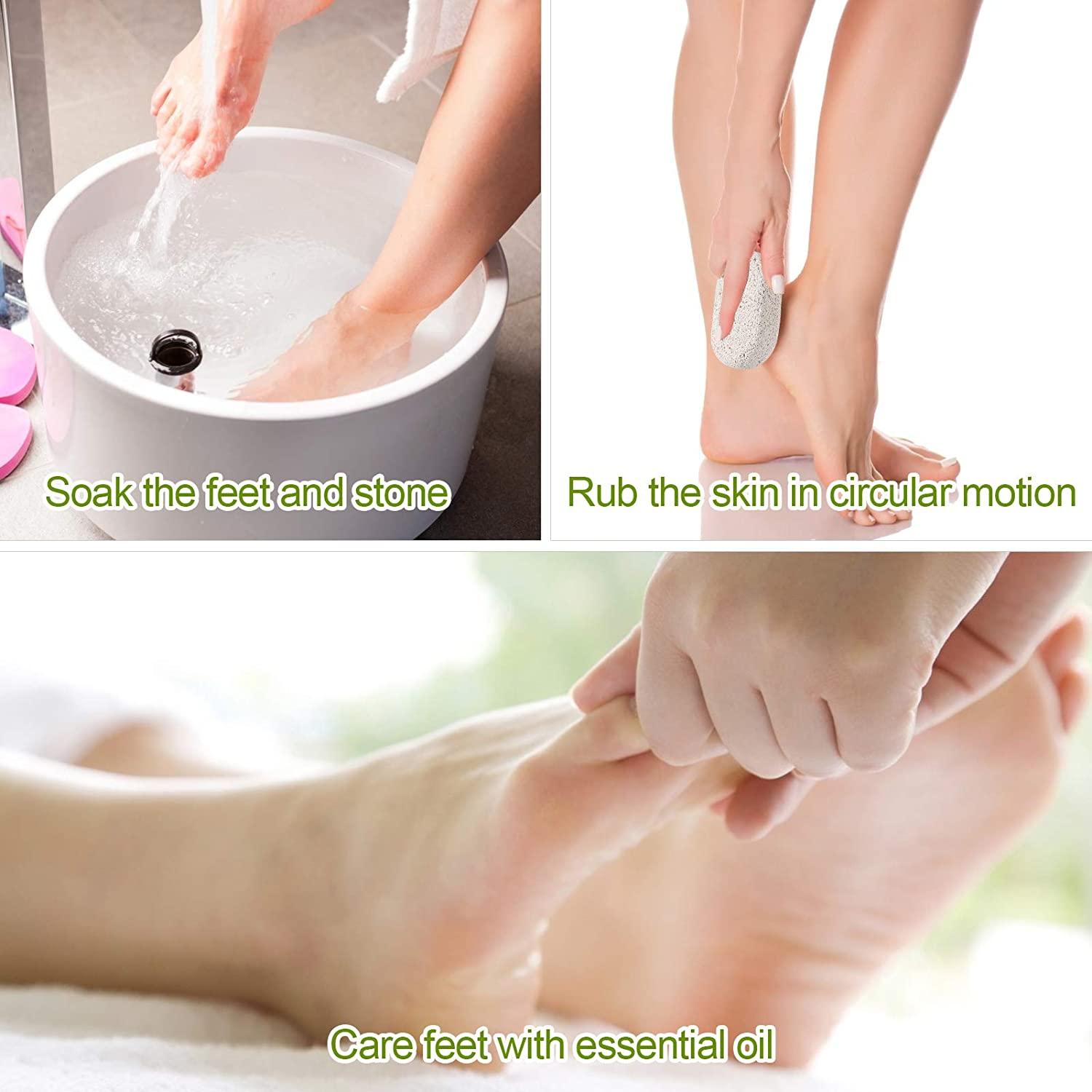 2PCS Natural Pumice Stone for Feet - Asqraqo Lava Pedicure Tools Hard Skin  Callus Remover for Feet and Hands - Natural Foot File Exfoliation to Remove  Dead Skin, and Callusess