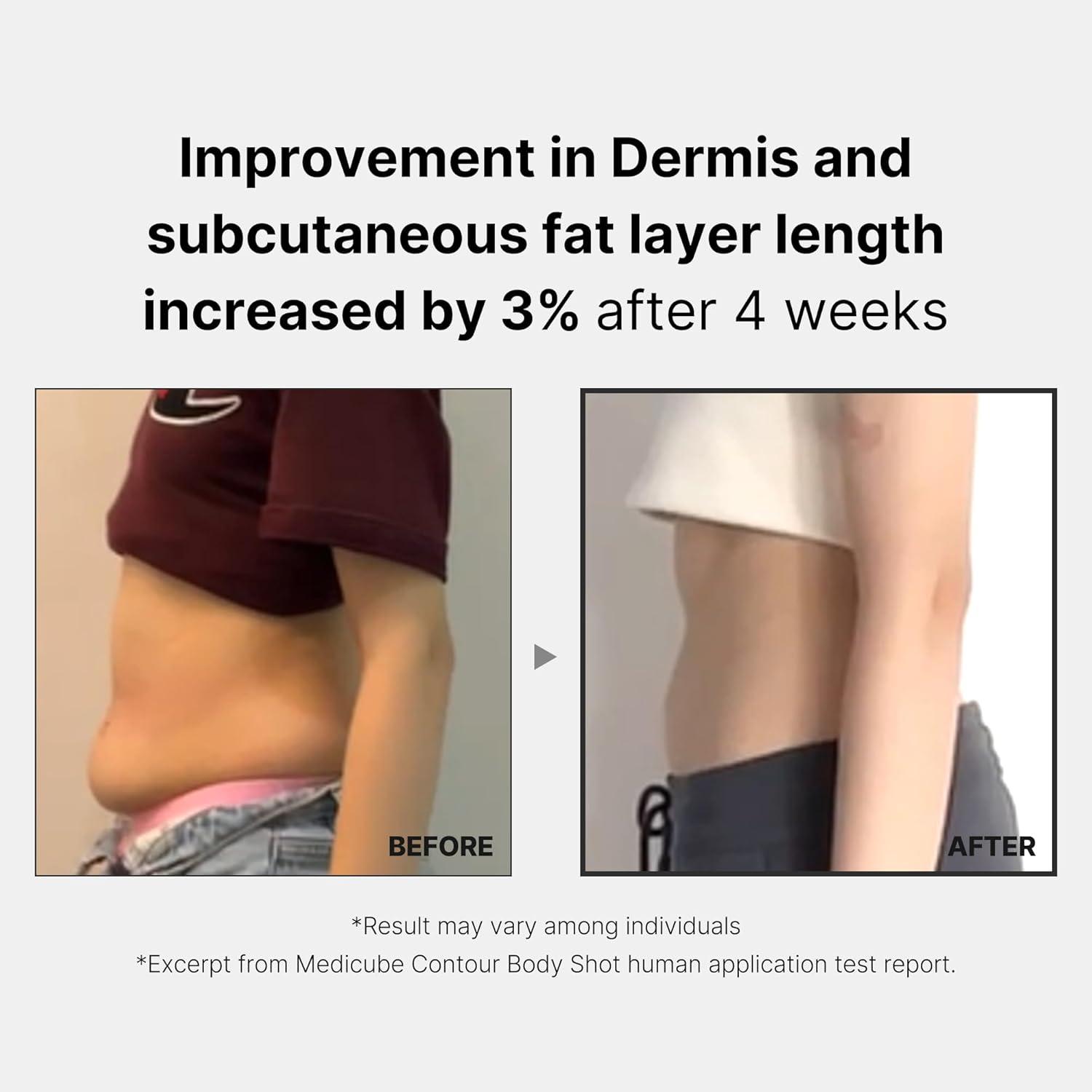 Medicube Age-R Contour Body Shot - A Body Slim Contouring Device