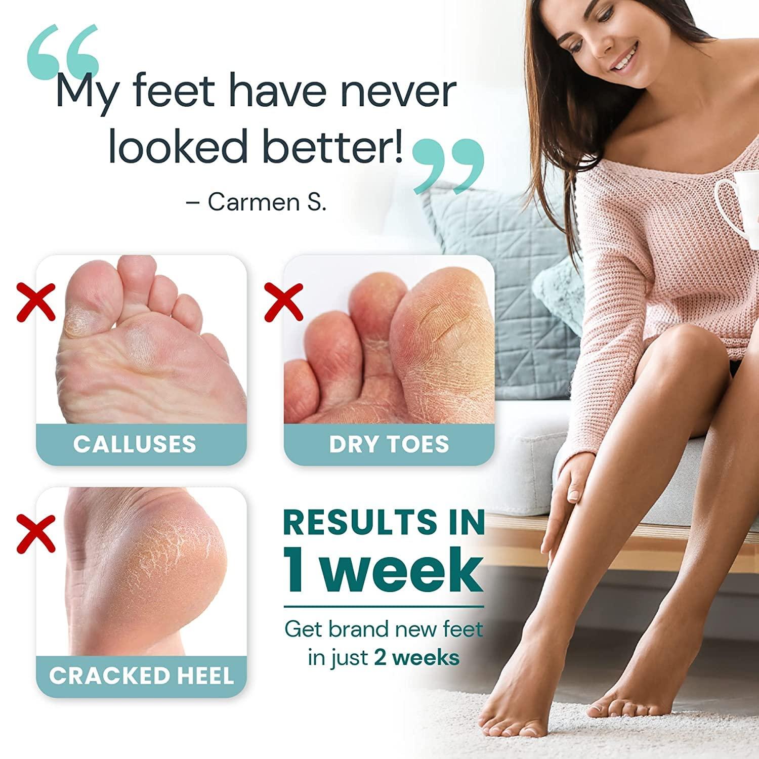 L'AMOUR yes! Exfoliating Foot Peeling Masks Feet Peeling Mask Peels