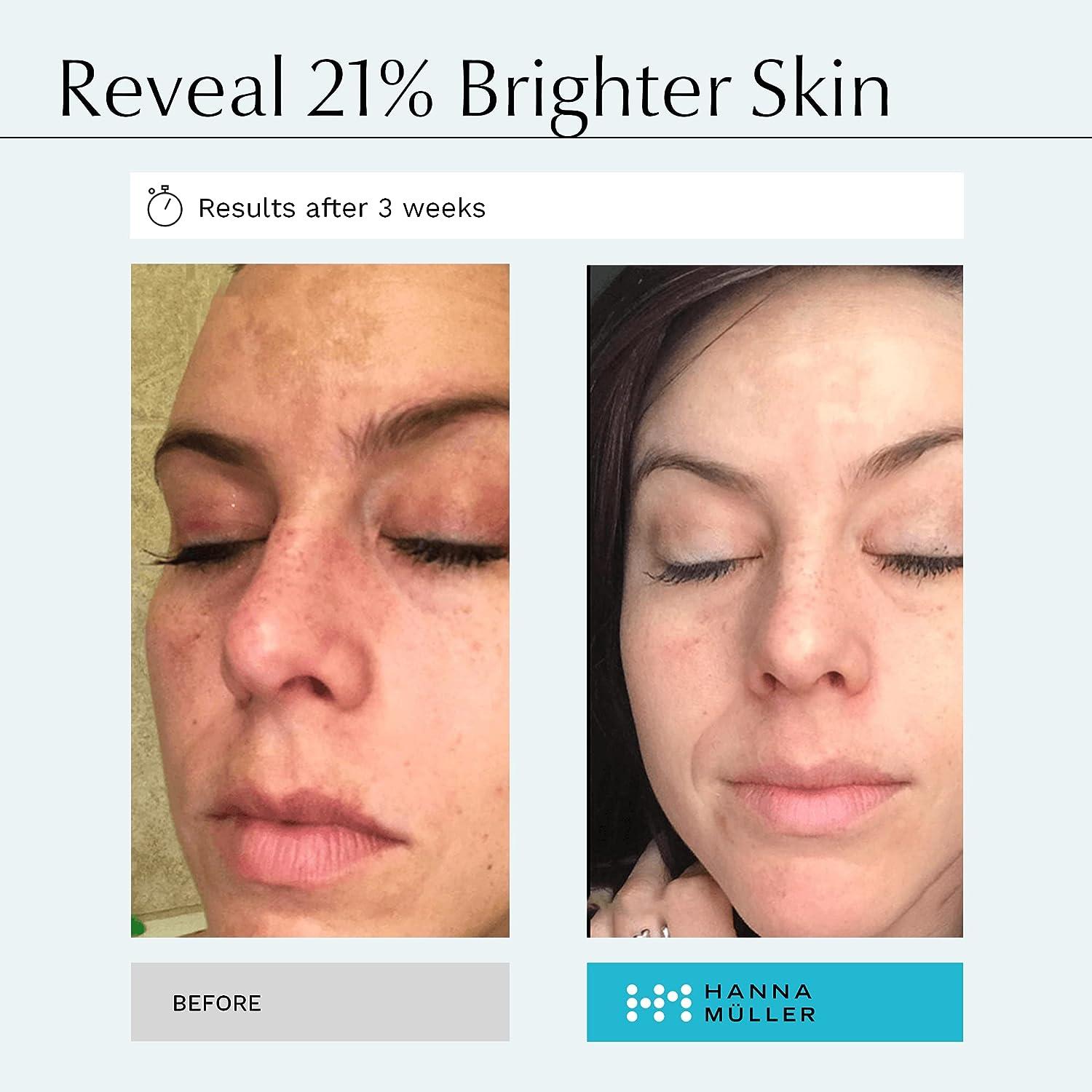 Kojic Acid Serum for Face - 2% Pure Kojic Acid with Ferulic Acid, Aloe Vera,  Vitamin E - Skin Brightening Formula for Dark Spots, Discoloration,  Hyperpigmentation | Buy Now with Express International Delivery |  GoSupps.com