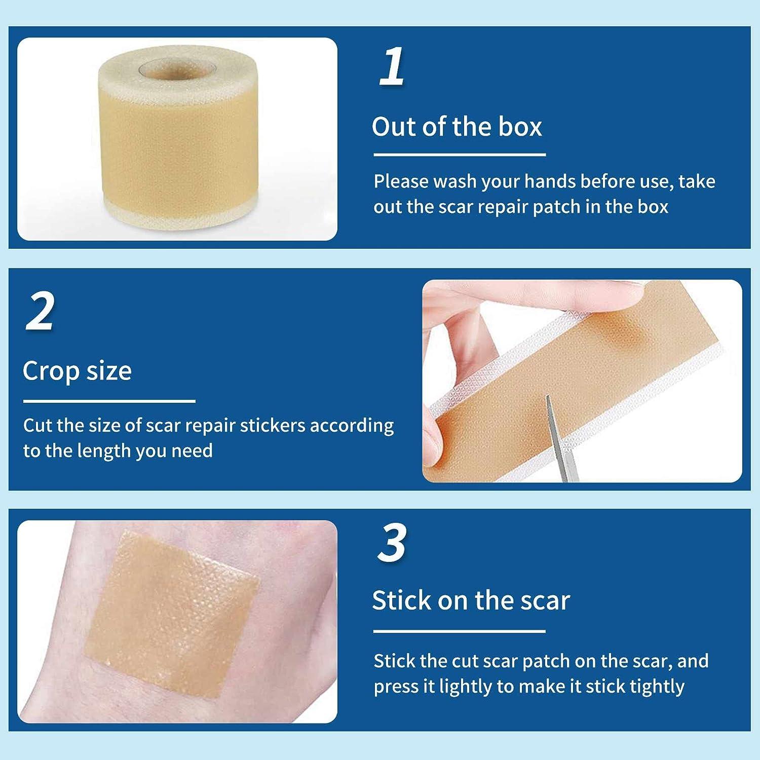 Silicone Scar Sheets (1.6 x 60 ) Scar Reducing Silicone Scar Sheets