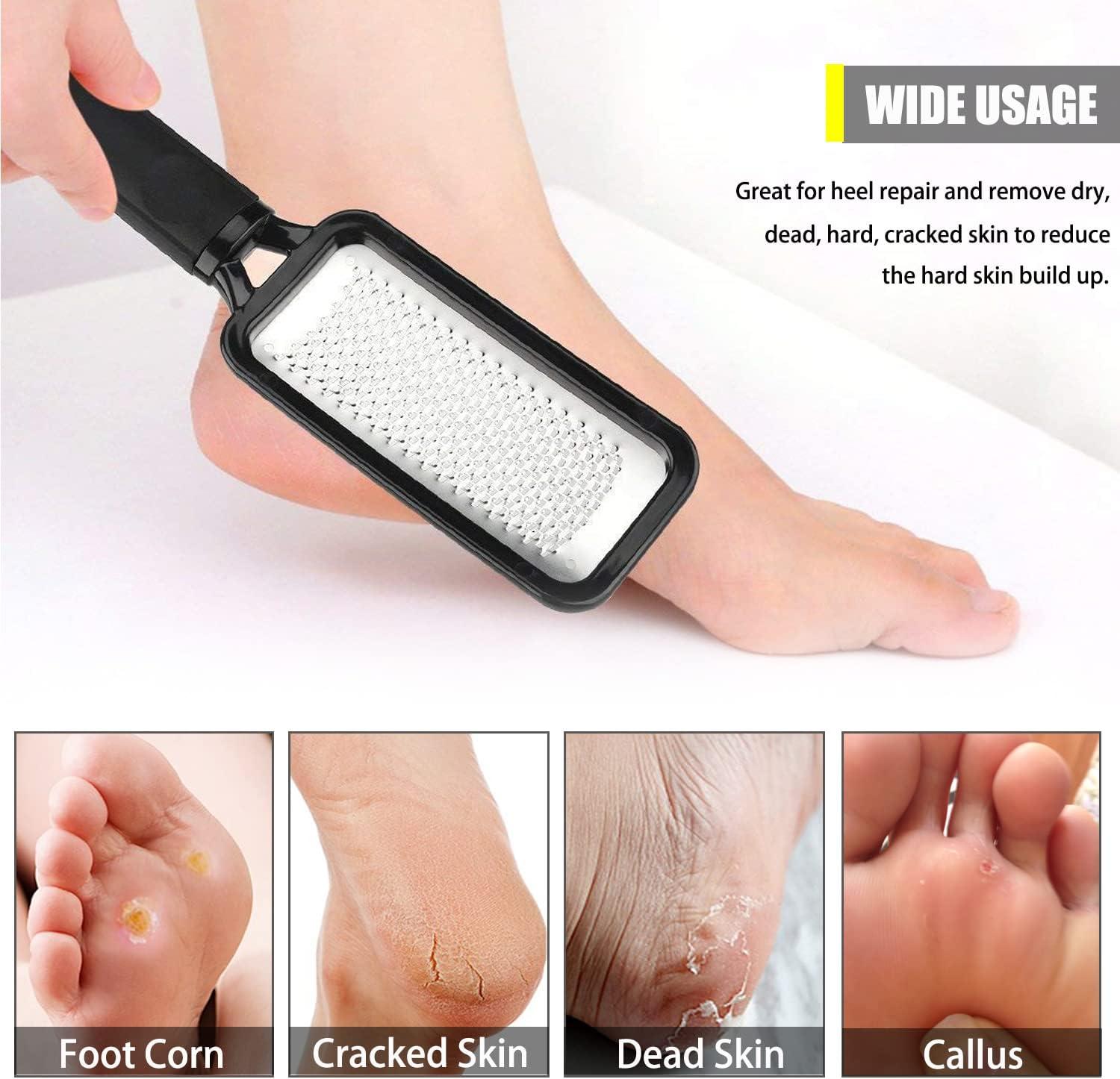  Professional Foot File Callus Remover, Colossal Foot