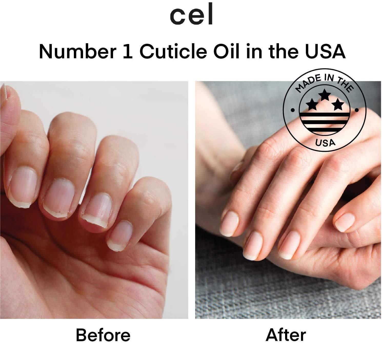 Skin and Nail Changes and Cancer Treatment - Side Effects - NCI
