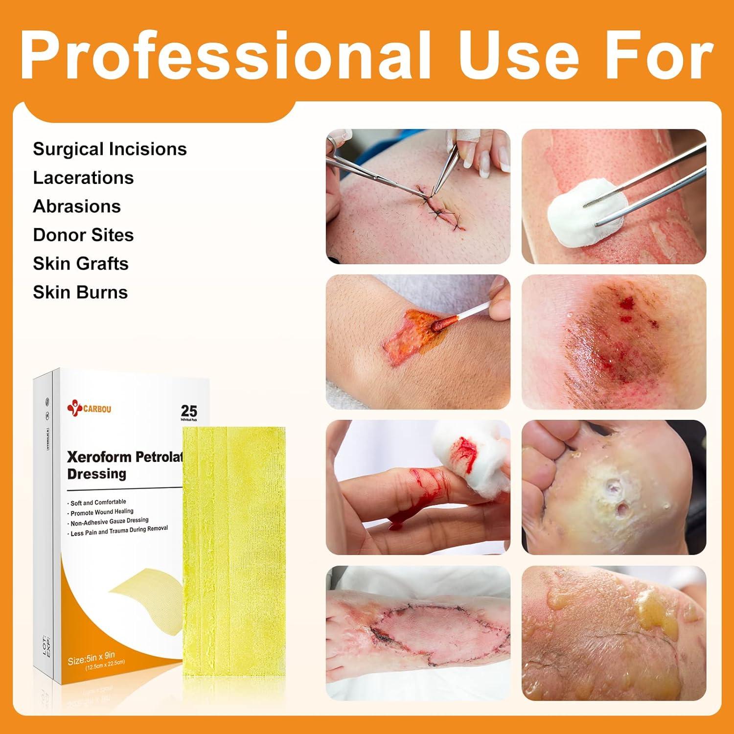 Carbou Medical Xeroform Petrolatum Dressing 5x9 25 Pack, NonAdherent Gauze Pads for Wound