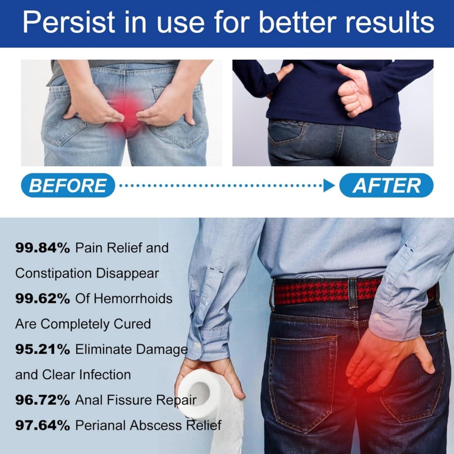 Natural Herbal Strength Hemorrhoid Capsules Natural Hemorrhoid