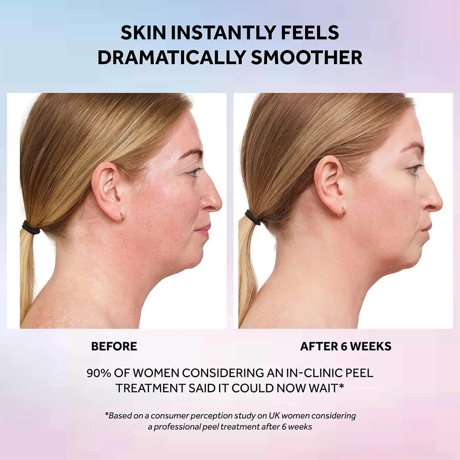 No7 Laboratories Resurfacing Peel 15 Glycolic Acid Skin Resurfacing Face Peel for Smoother