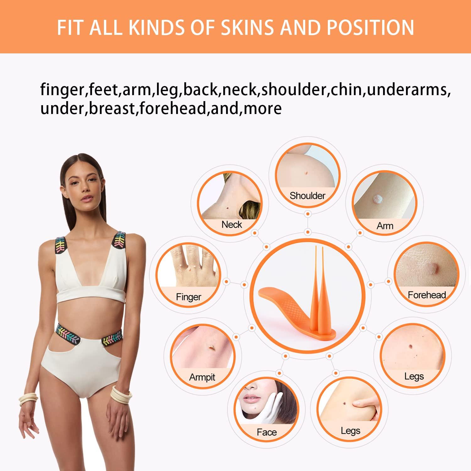 MEIJU Skin Tag Removers 2in1 Removal Kit for Small to Large Skin