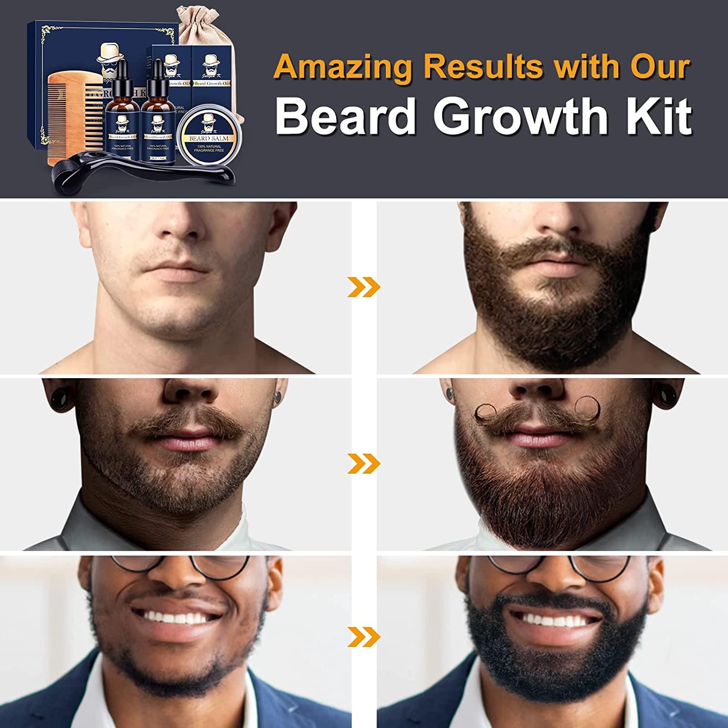 Beard Growth Kit - Derma Roller for Beard Growth, Beard Kit with Beard  Growth Oil, Beard Balm, Comb, Facial Hair Growth Products for Patchy Beard,  Birthday Gifts for Men Husband Dad Boyfriend