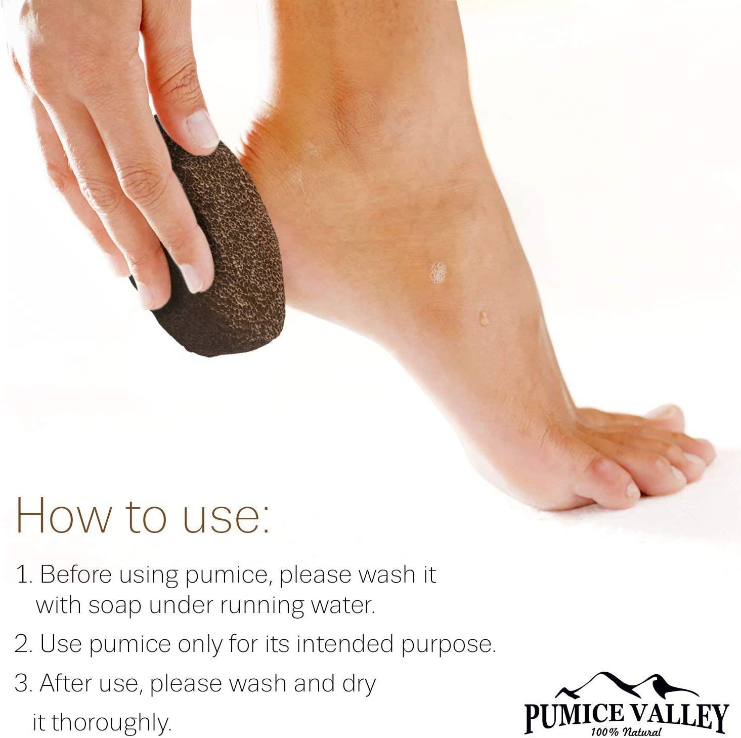 Pumice Stone for Feet Callus Remover - Earth Lava Foot Pumice Stone for  Callous Warts Dead Skin Removal - Natural Exfoliating Stone Foot Scrubber  for Dry Cracked Heels & Hands for Use
