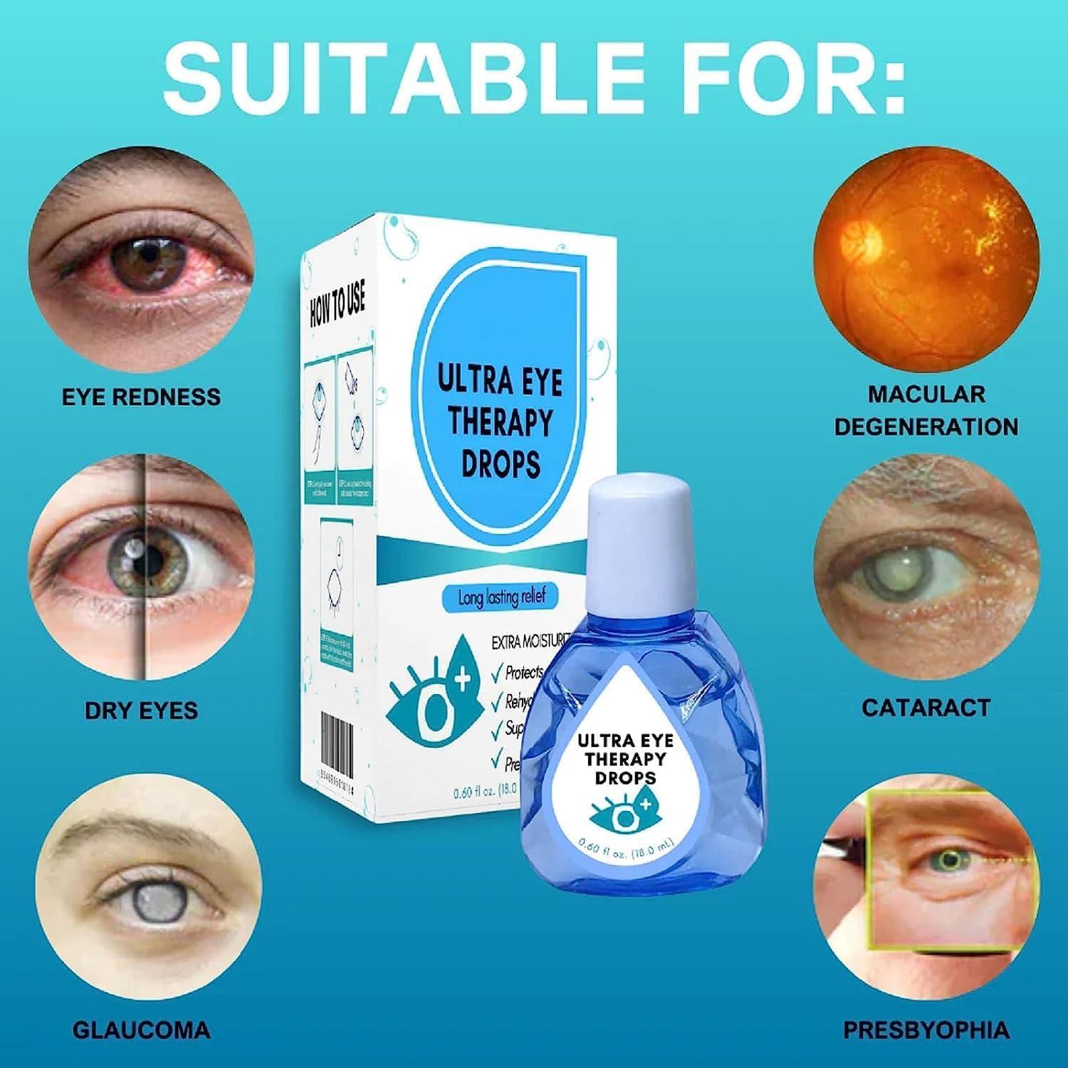 Optrex moisturising eye drops for dry eyes 10ml tesco groceries clearance