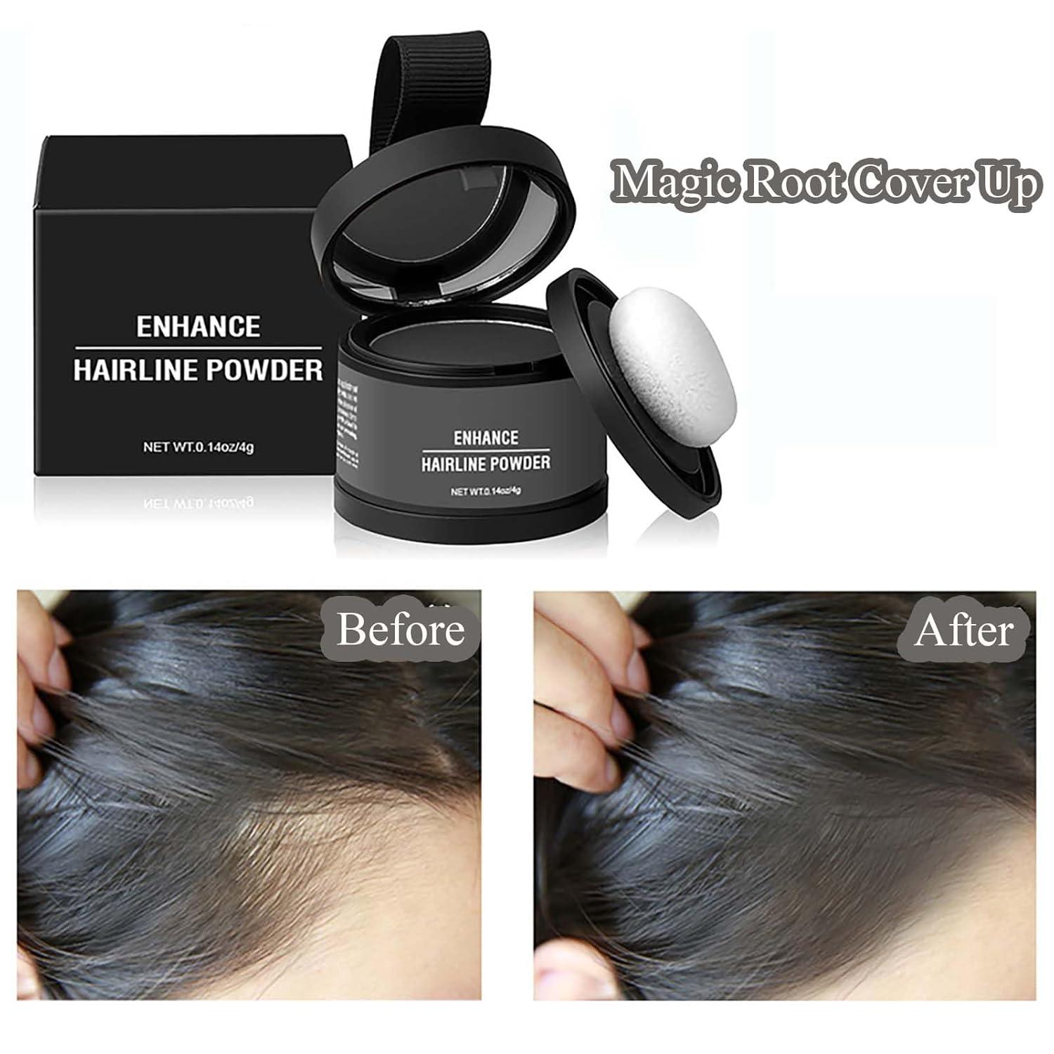 IMPERIO Root Touch Up Hair Powder For Concealing Hair Loss Instantly, Hairline Powder For Women & Men, Water Resistant Root Cover Up For Thinning Hair In Premium Hairdressing Quality (Black