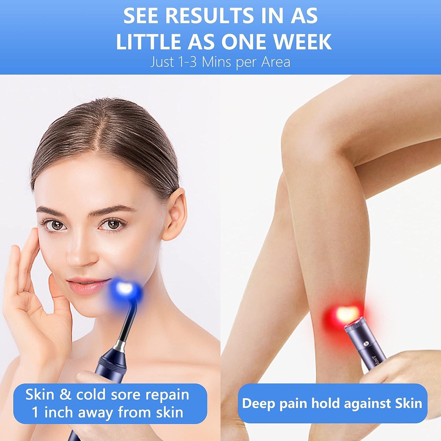 YooJooHee Red Light Therapy for Cold Sores & Pain Relief 5 Wavelengths