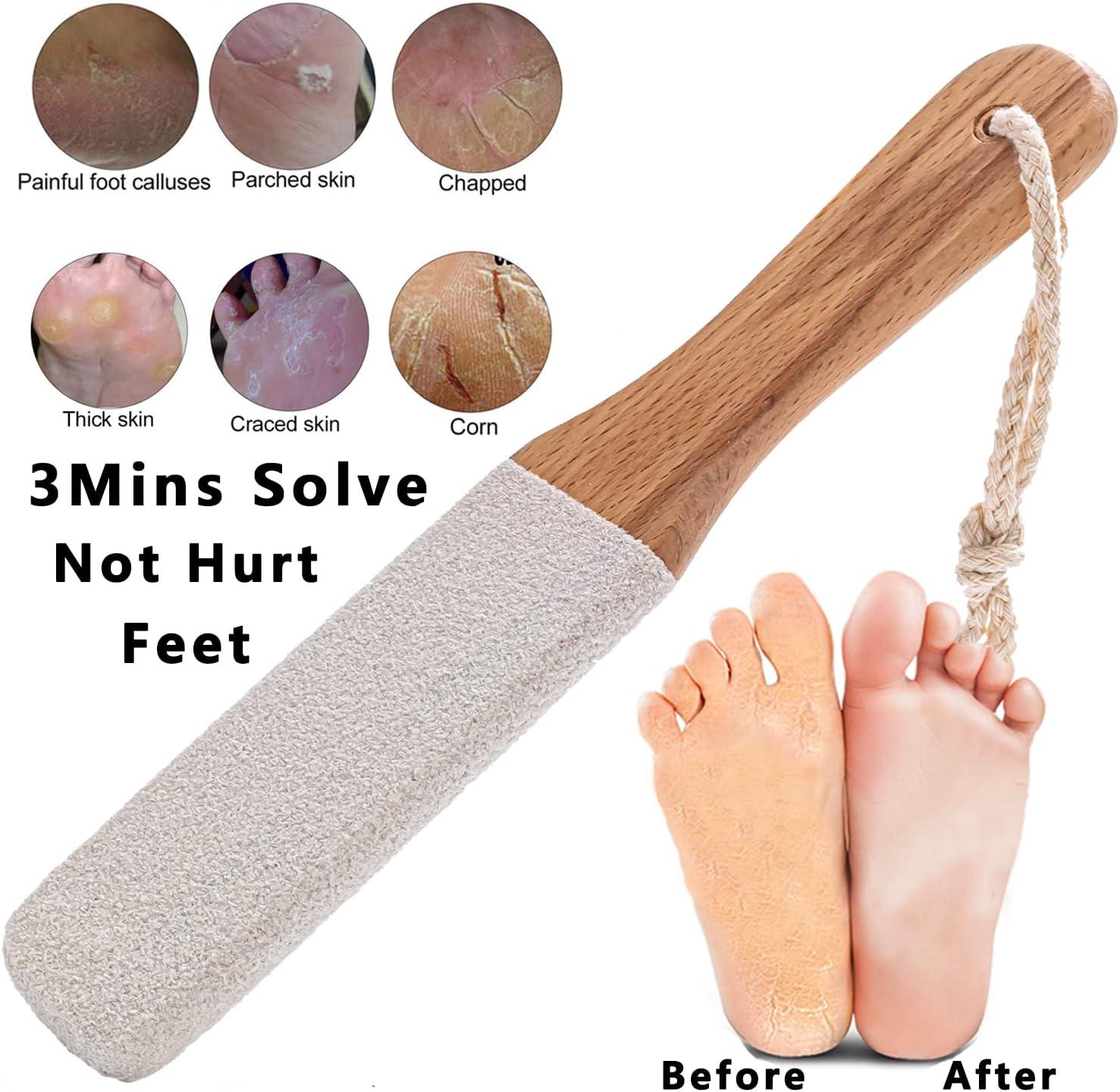 2022 Foot Callus Shaver & Scraper Remover -Callous Removers For Feet Tools 