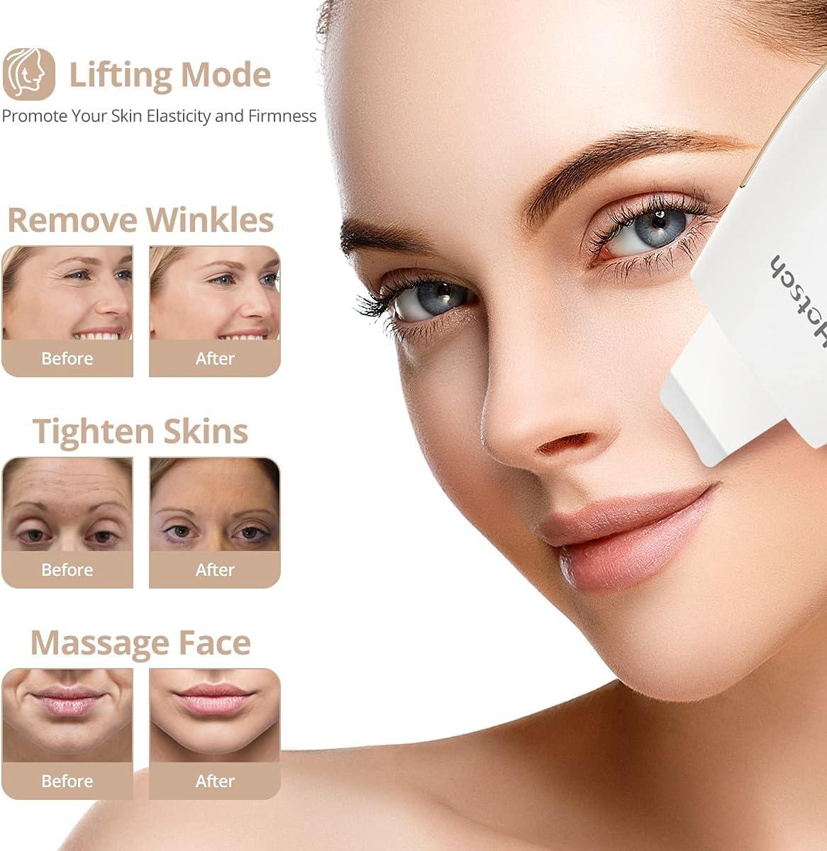 Ultrasonic Skin Scrubber Facial Spatula Blackhead Remover Facial Deep  Cleansing Face Lift Machine Peeling Shovel Pore