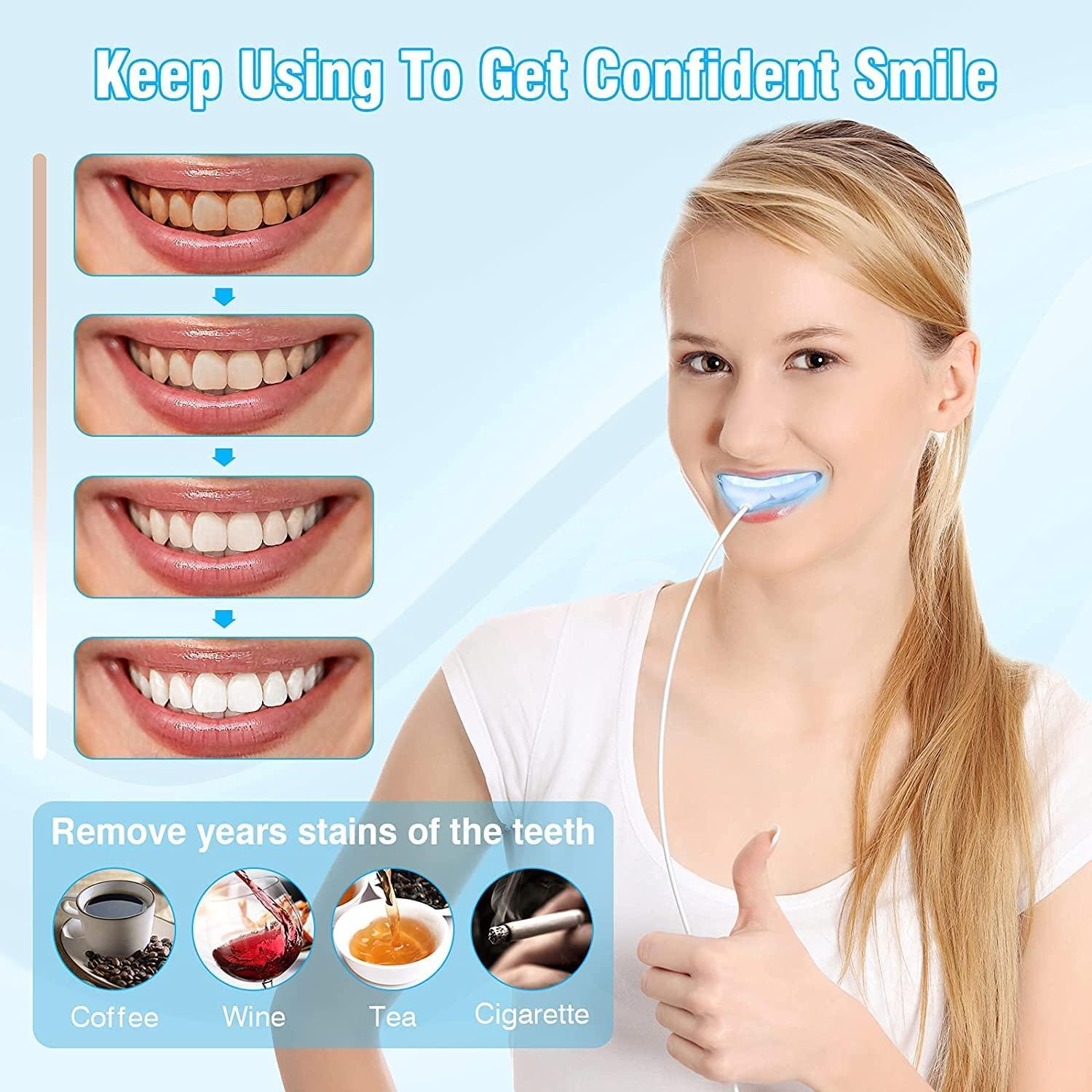 DOUCEUR Teeth Whitening Kit , Teeth Whitener with 5 Teeth Whitening