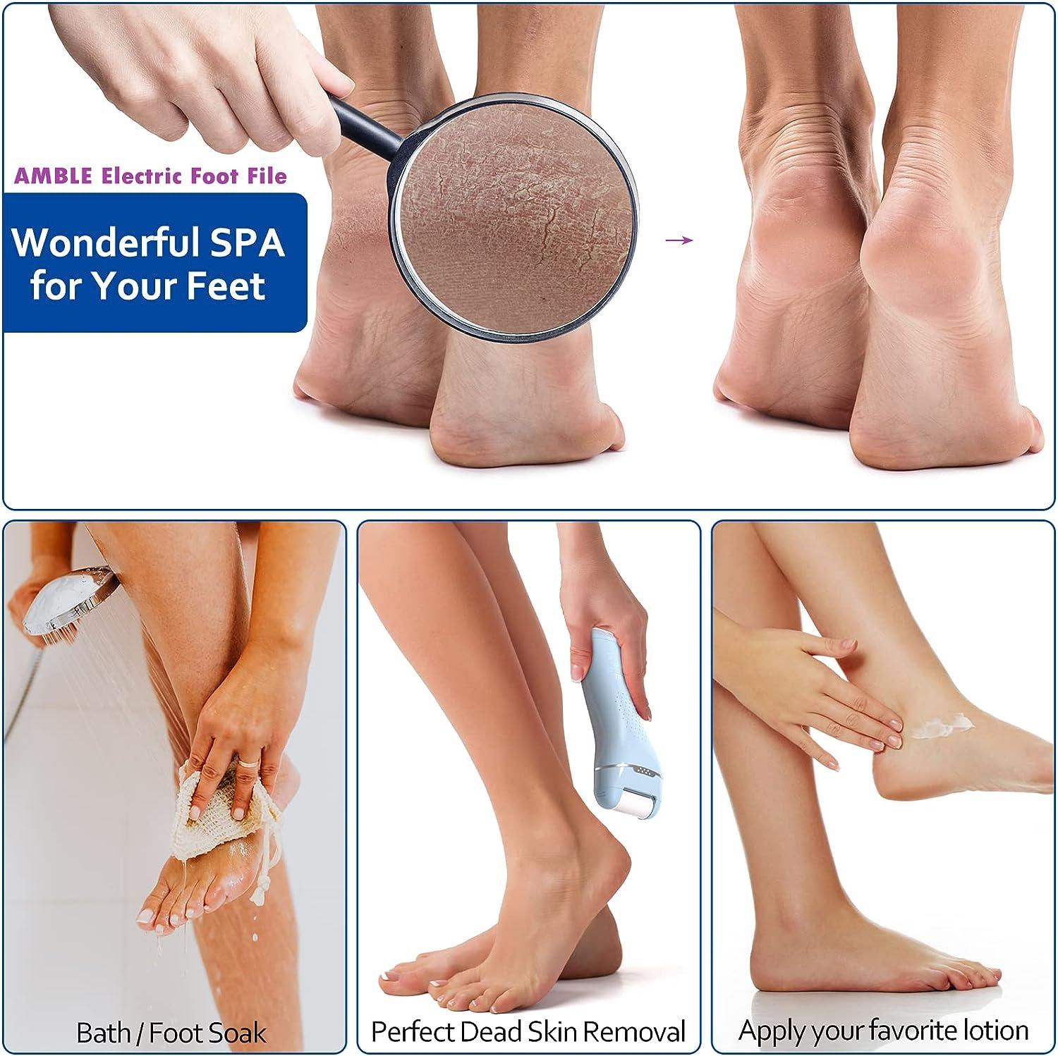 Professional Foot Callus Shaver Heel Hard Skin Remover Hand Feet Pedicure  Razor Tool Callus Remover Scraper