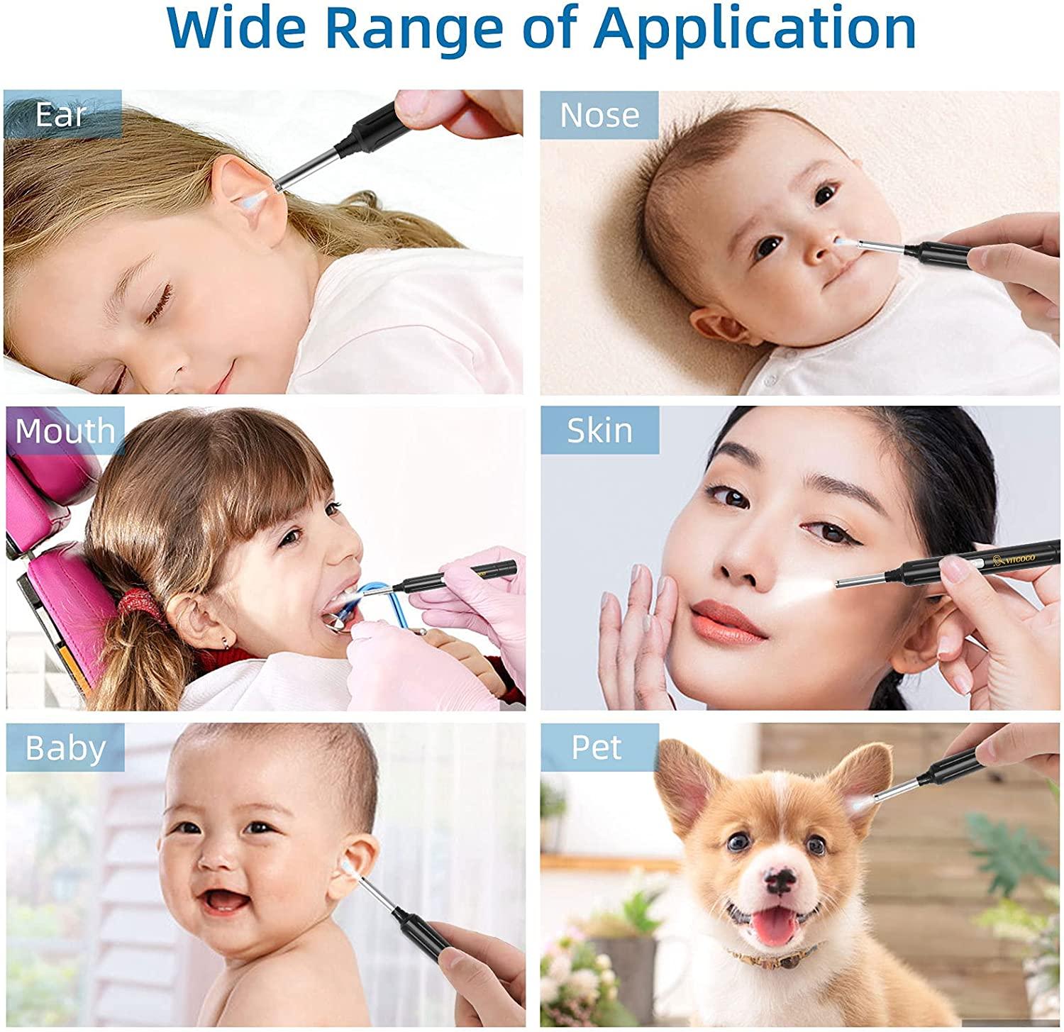 VITCOCO Ear Wax Removal, Wireless Ear Cleaner with 1296P HD Ear Camera