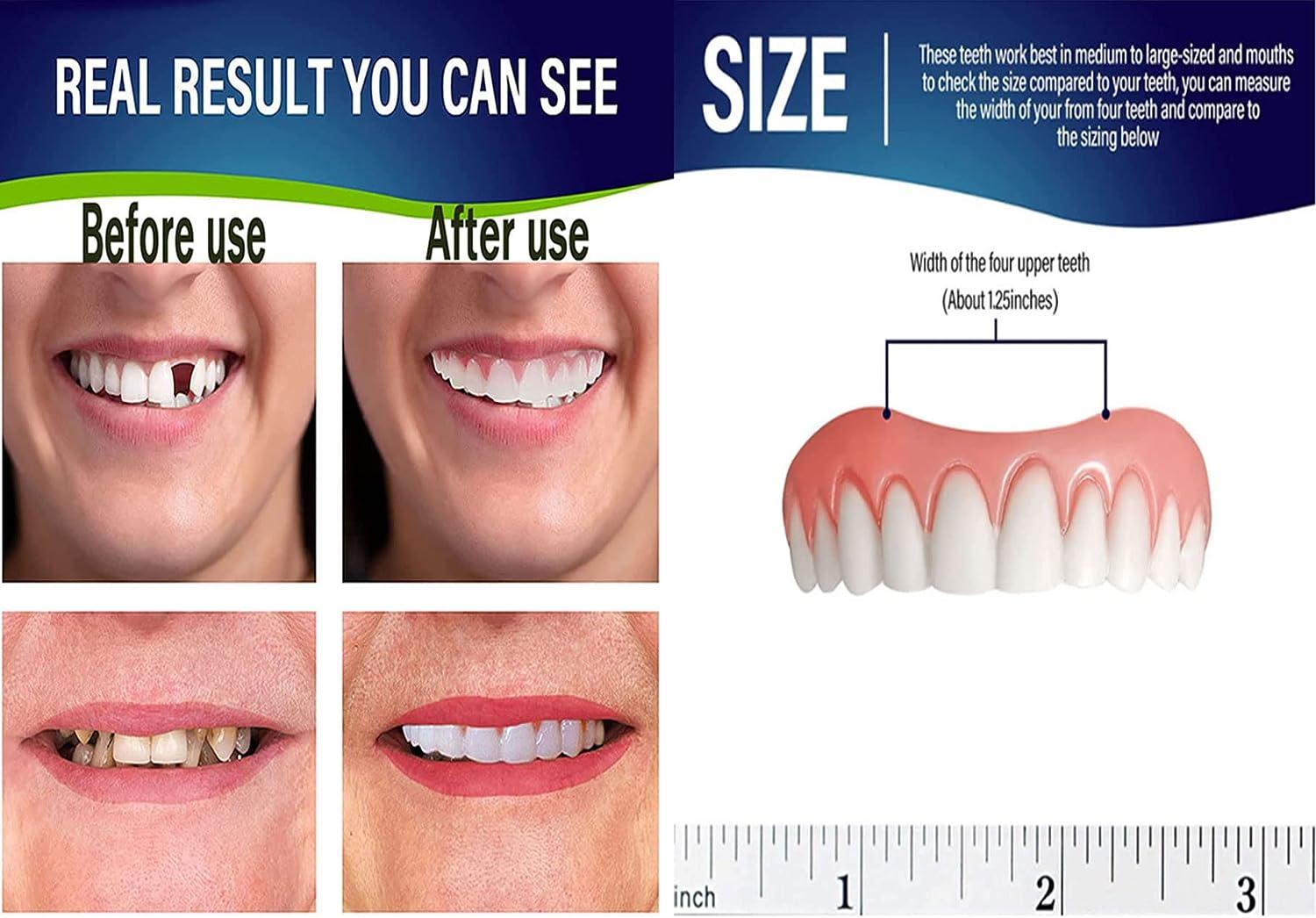 Three Temporary Tooth Repair Kits Thermal bonding Accessories Beads