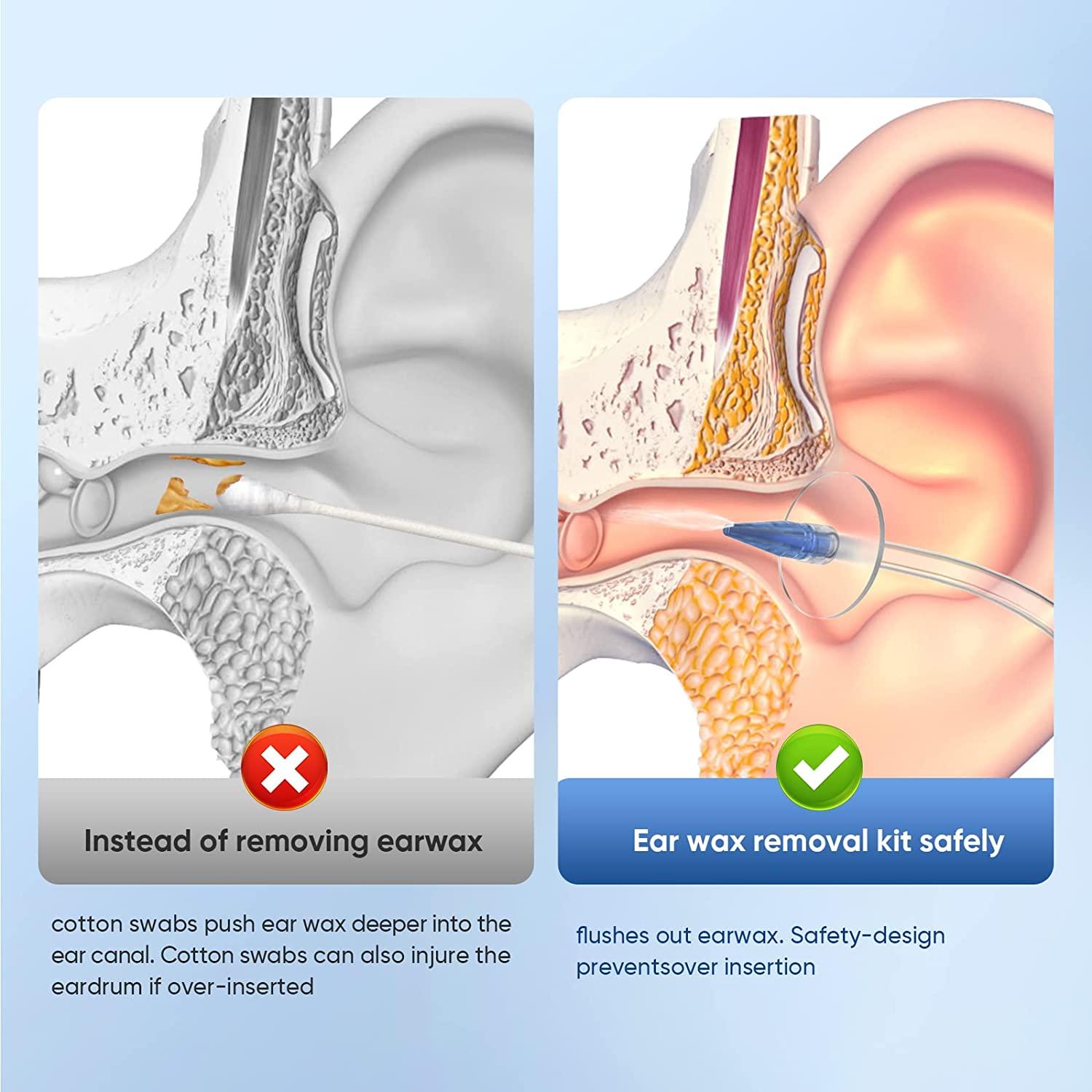 WEUANY Ear Wax Removal, Ear Cleaner, Earwax Removal Kit, Manual Ear