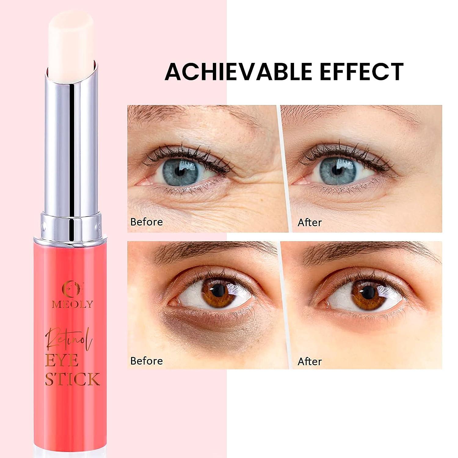 Retinol Eye Cream Stick AntiAging Treatment for Dark Circles