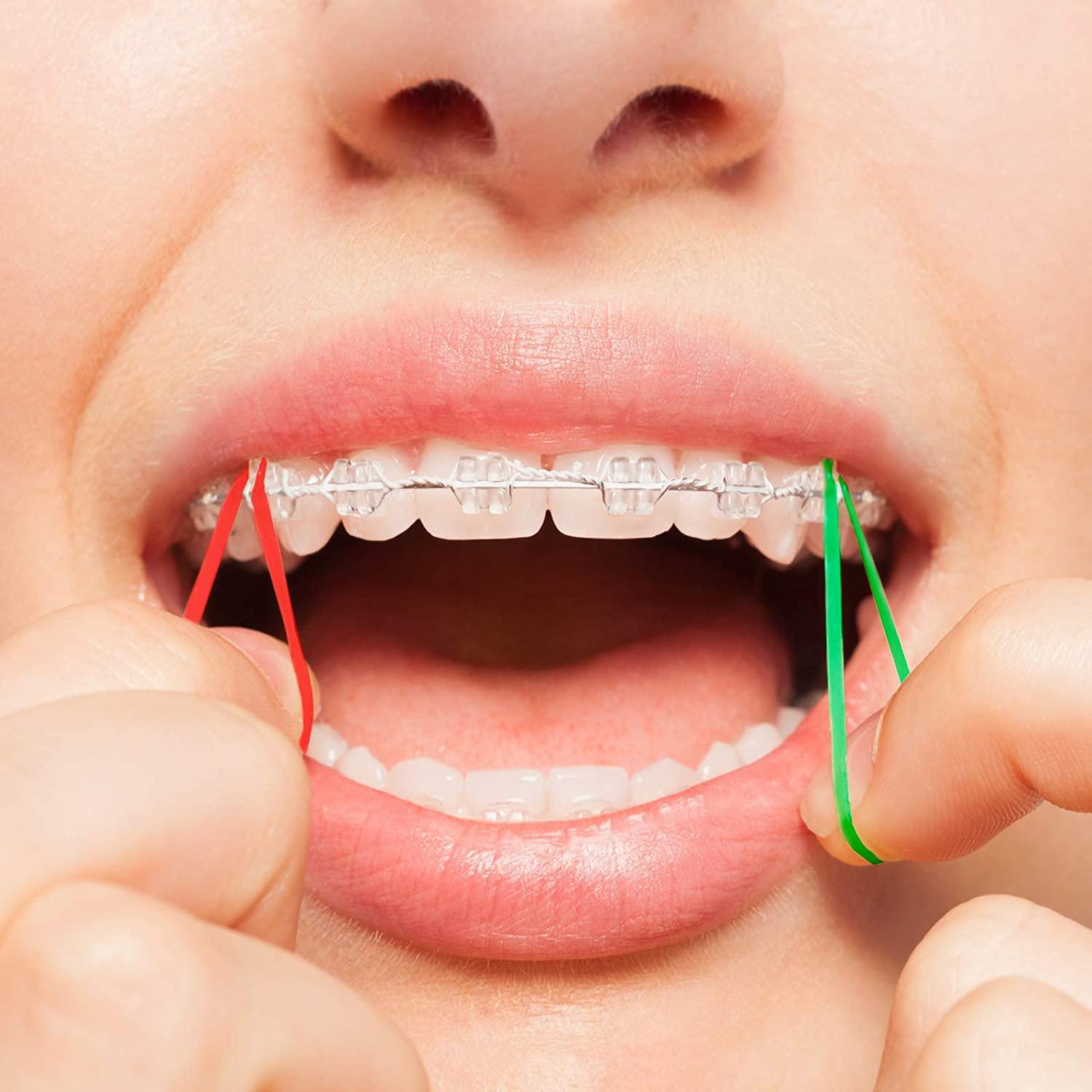 JMU Orthodontic Neon Elastics 3/16 Inch Heavy 6.5oz 500 pack Intraoral