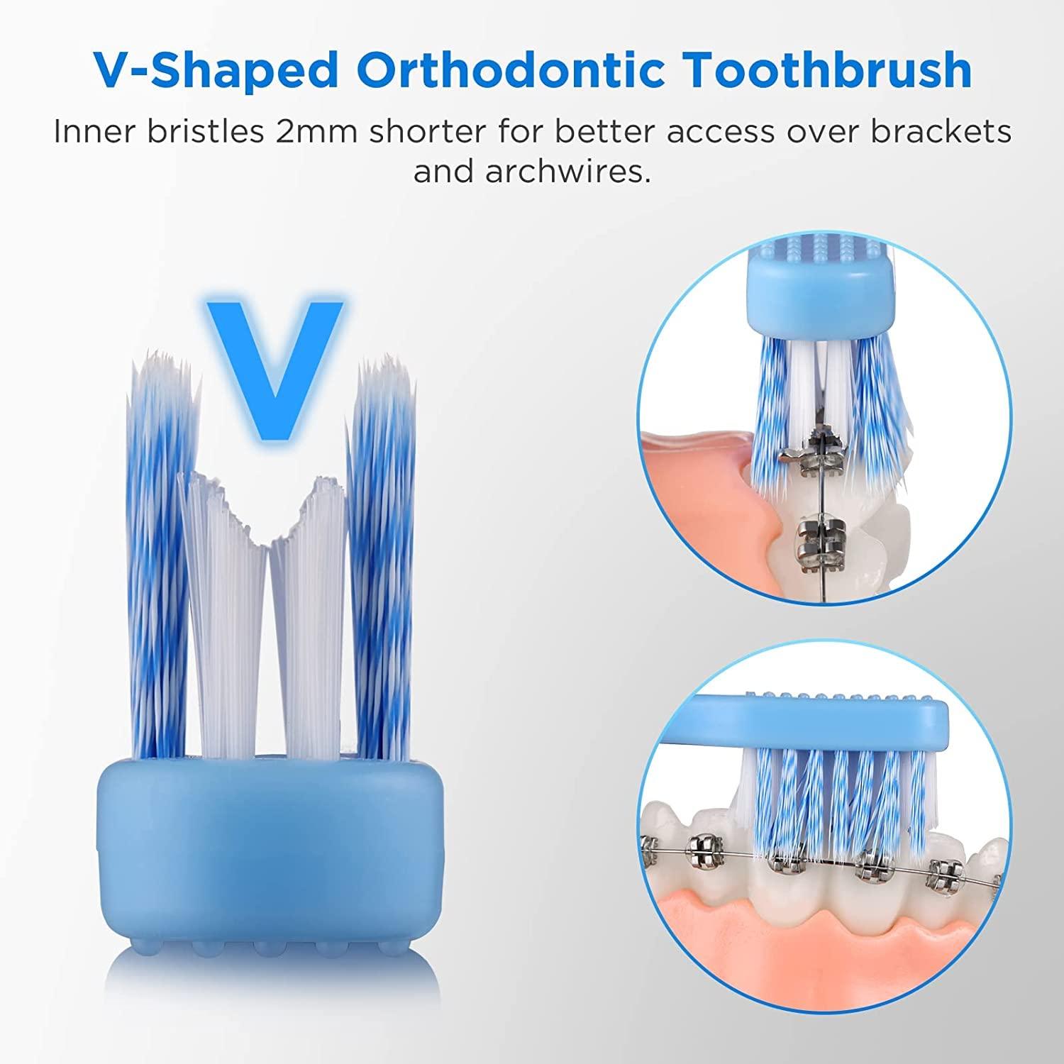 Fremouth VShaped Orthodontic Toothbrush for Braces Soft Bristles, 6