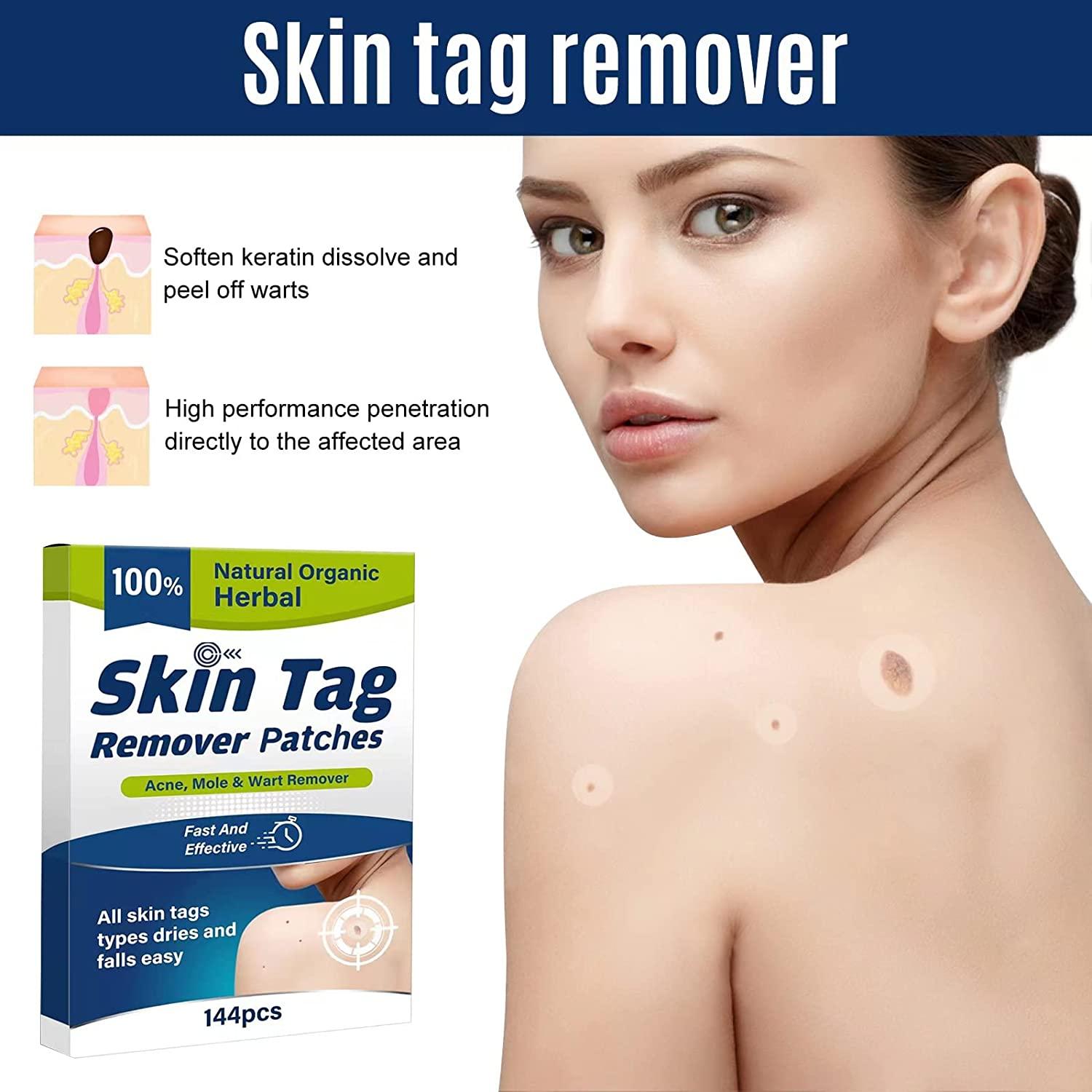 Skin Tag Remover Patch, 144 PCS Safe and Effective Formula Skin Tag