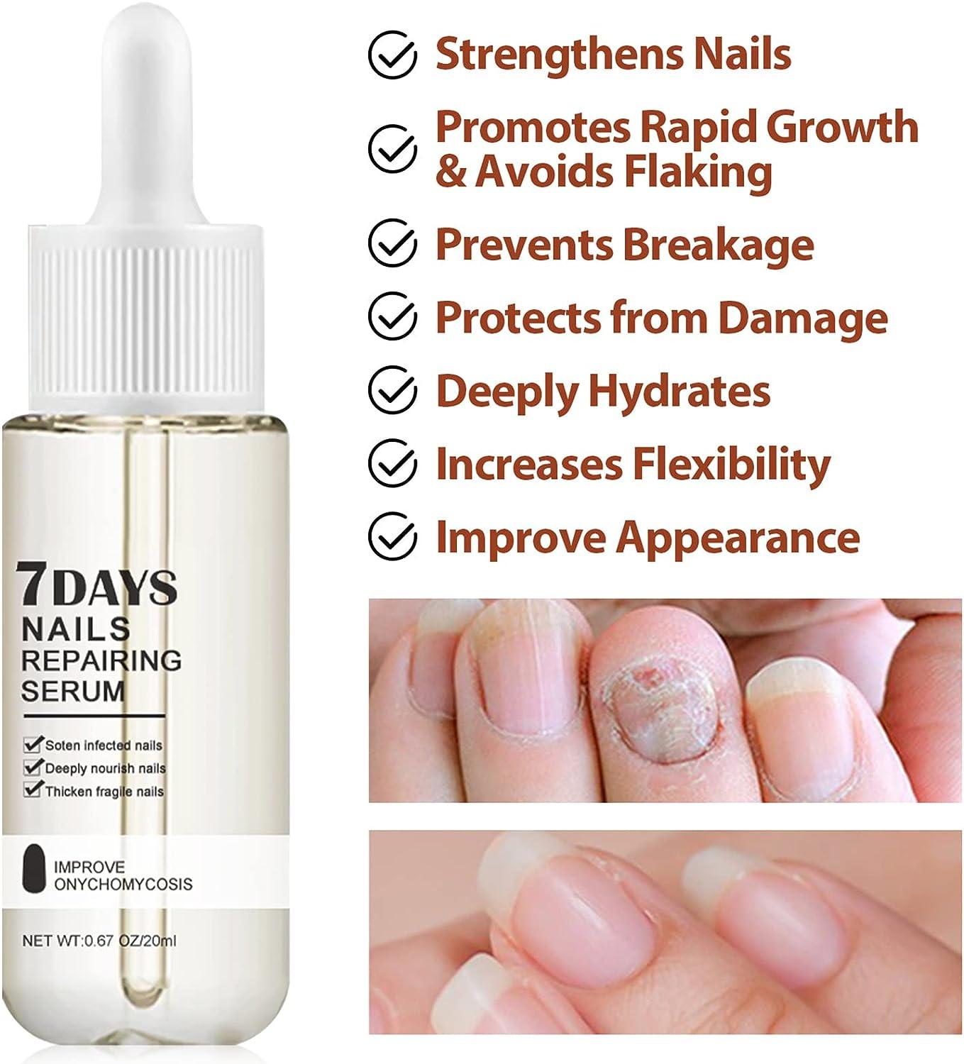 High Profit Margin Mlm Product In India, Nail Growth Serum For Long,Nail  Growth Products at Rs 39/piece | Herbal Products in Meerut | ID:  2852629185091