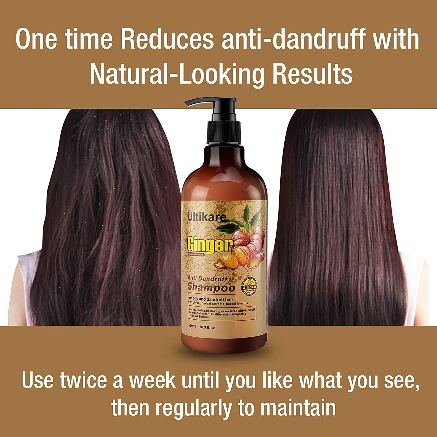 Dandruff Shampoo, Ultikare Itchy Dry Scalp Treats & Anti-Dandruff, Deep  Nourishment Daily Use Care, Anti-Dandruff Treatment with Ginger, Deep Clean  for Dry, Frizzy or Curly, Color-Treated Hair for Women & Men 