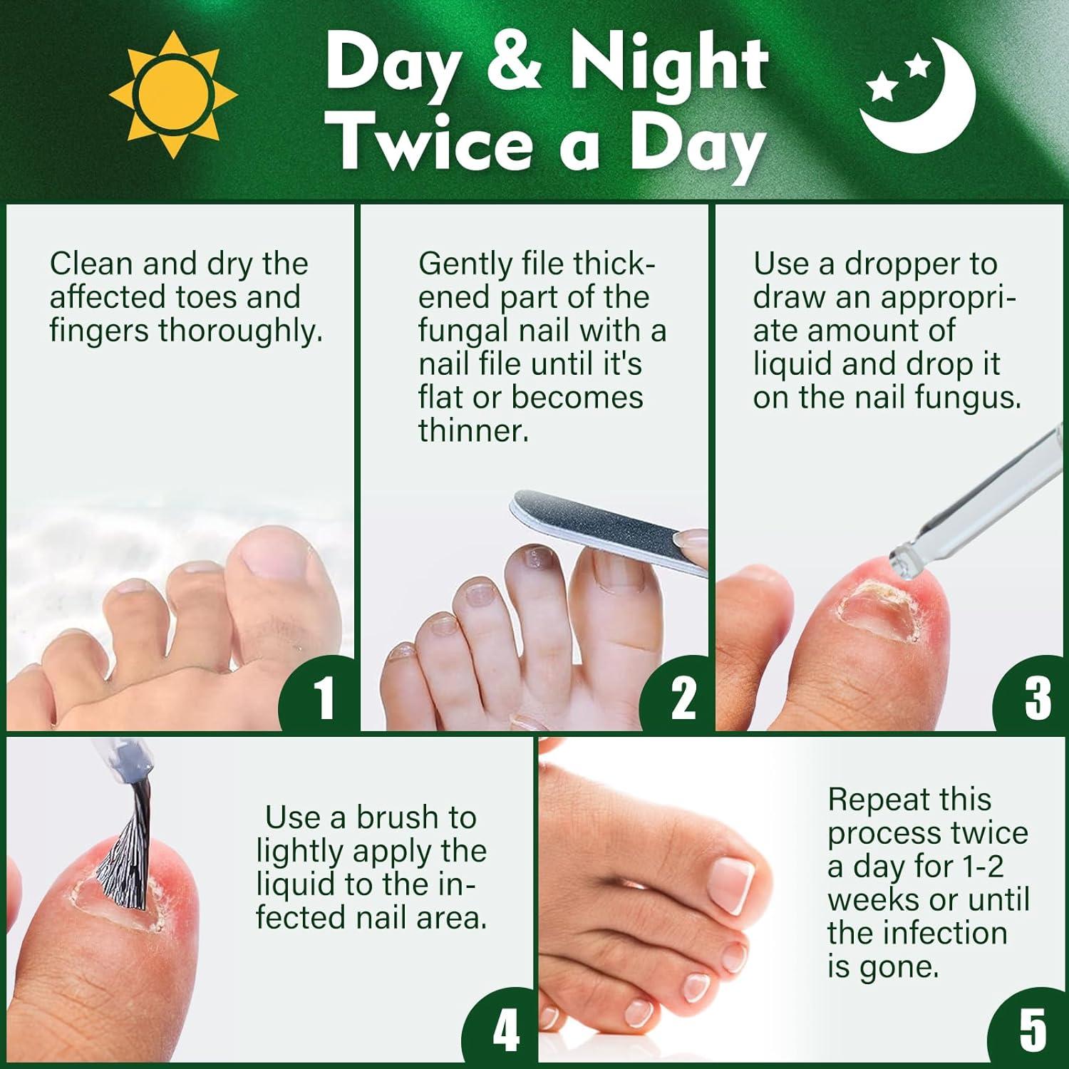 Fungal Nail Treatment Toenail Fungus Treatment Extra Strong Nail Repair