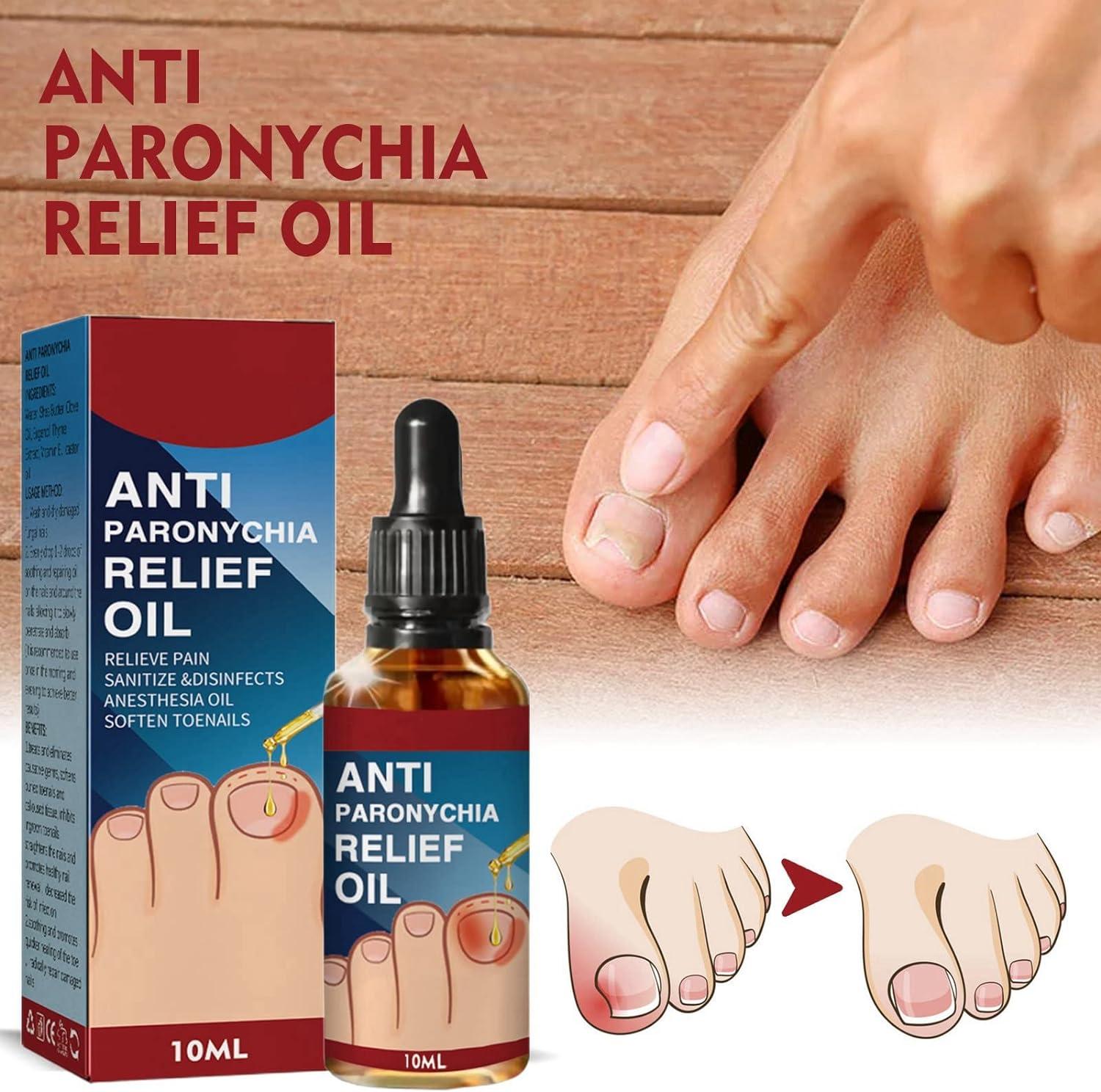 2PCS Ingrown Toenail Treatment Anti Paronychia Relief Oil Ingrowing