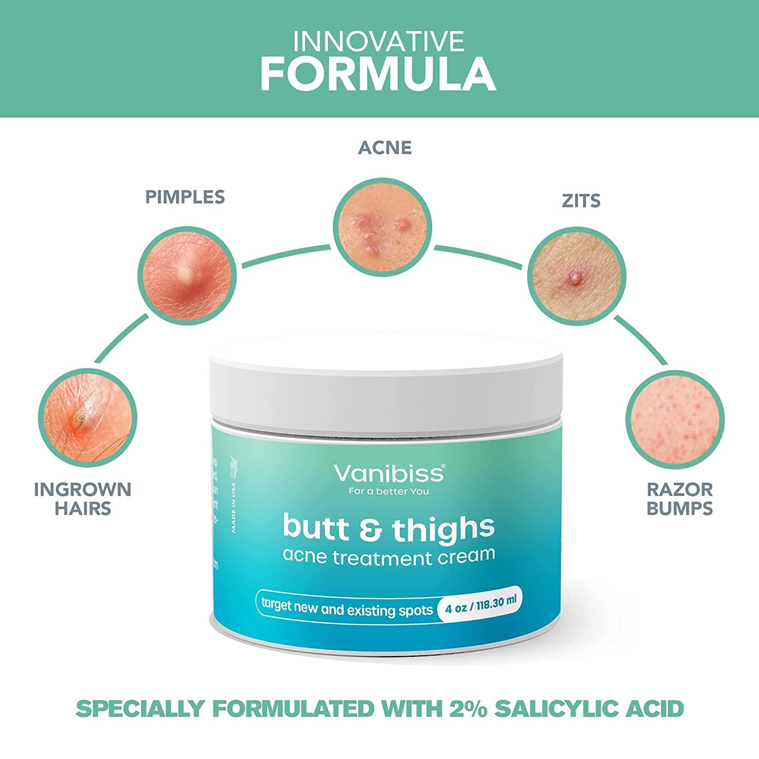 Vanibiss Butt & Thighs Acne Treatment Cream Butt Acne Clearing Cream